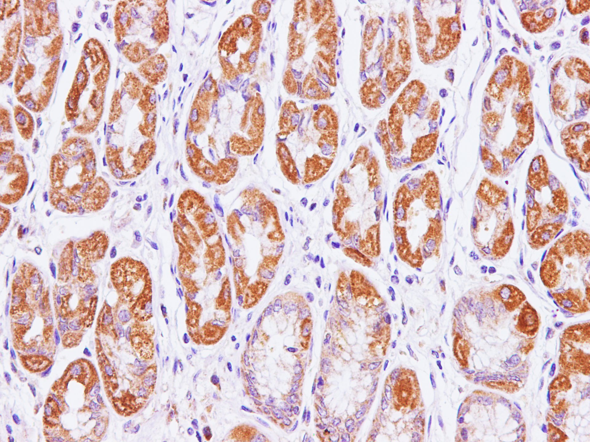 Immunohistochemistry of paraffin-embedded Human stomach using Cytochrome c1 Polyclonal Antibody at dilution of 1:100(400×)