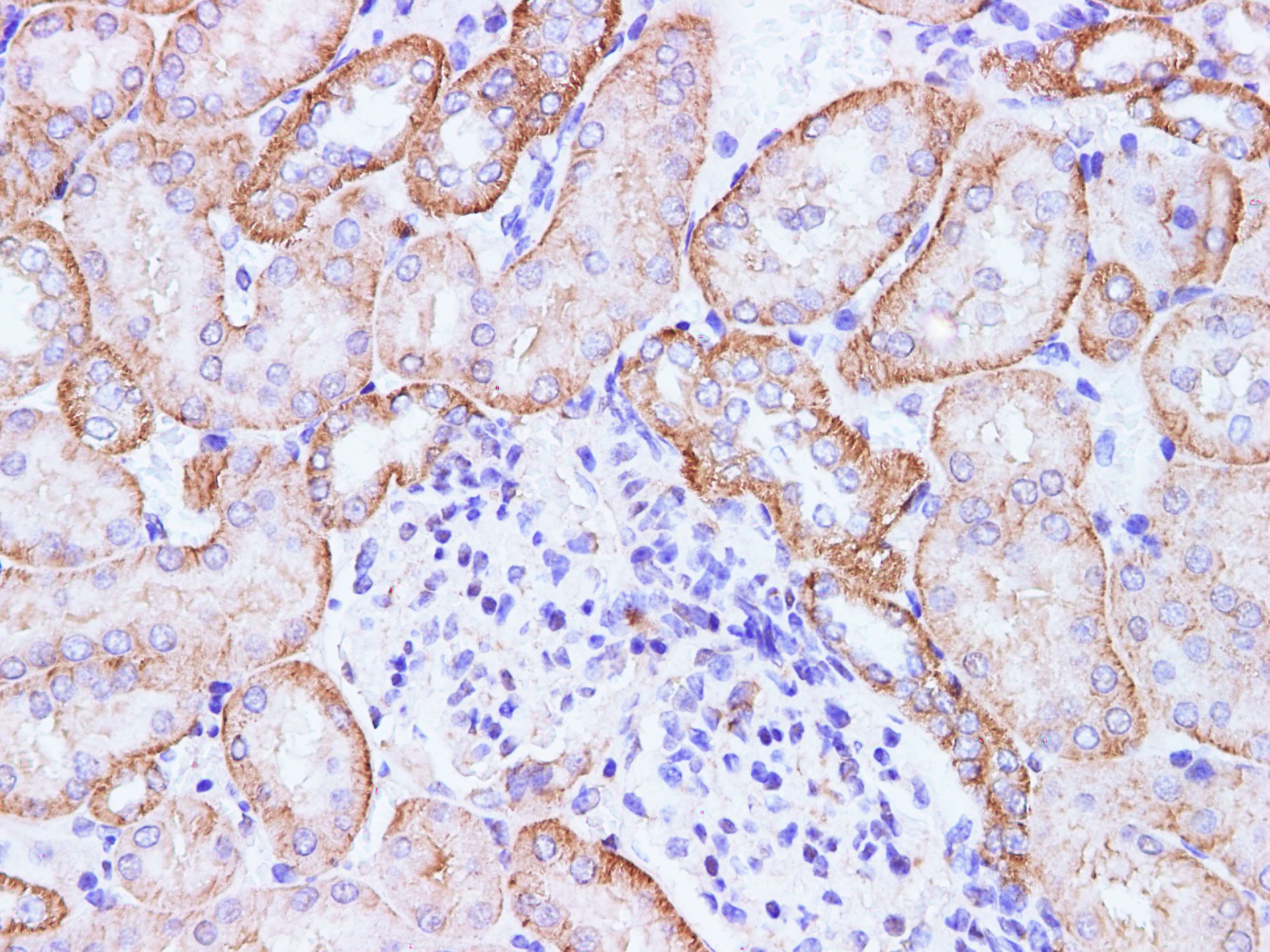 Immunohistochemistry of paraffin-embedded Mouse kidney using CCL2 Polyclonal Antibody at dilution of 1:100