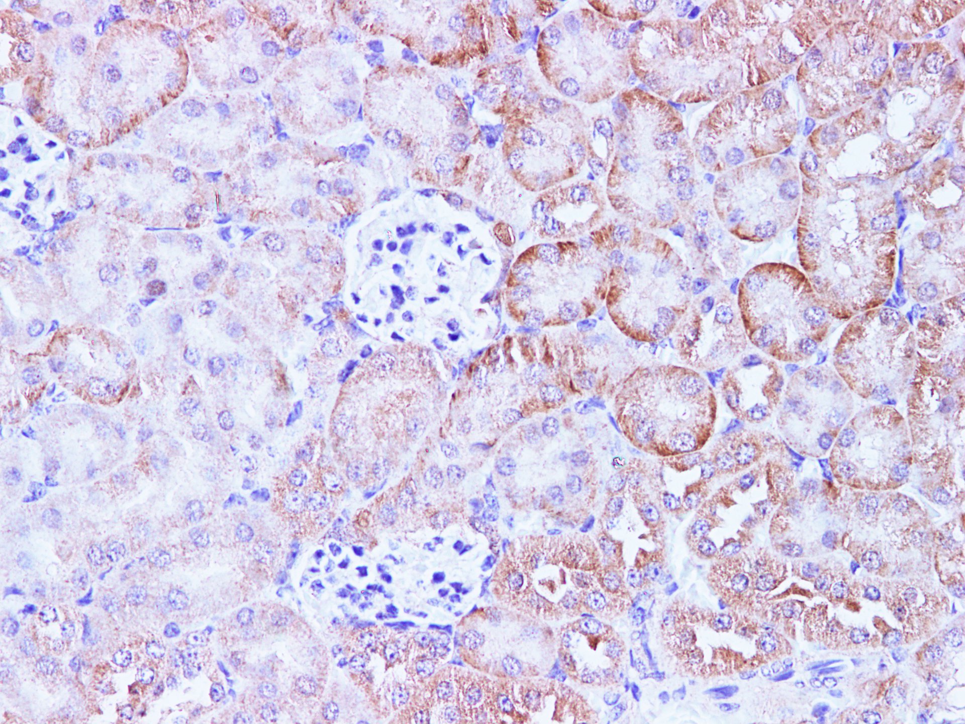 Immunohistochemistry of paraffin-embedded Mouse kidney using CCL2 Polyclonal Antibody at dilution of 1:100