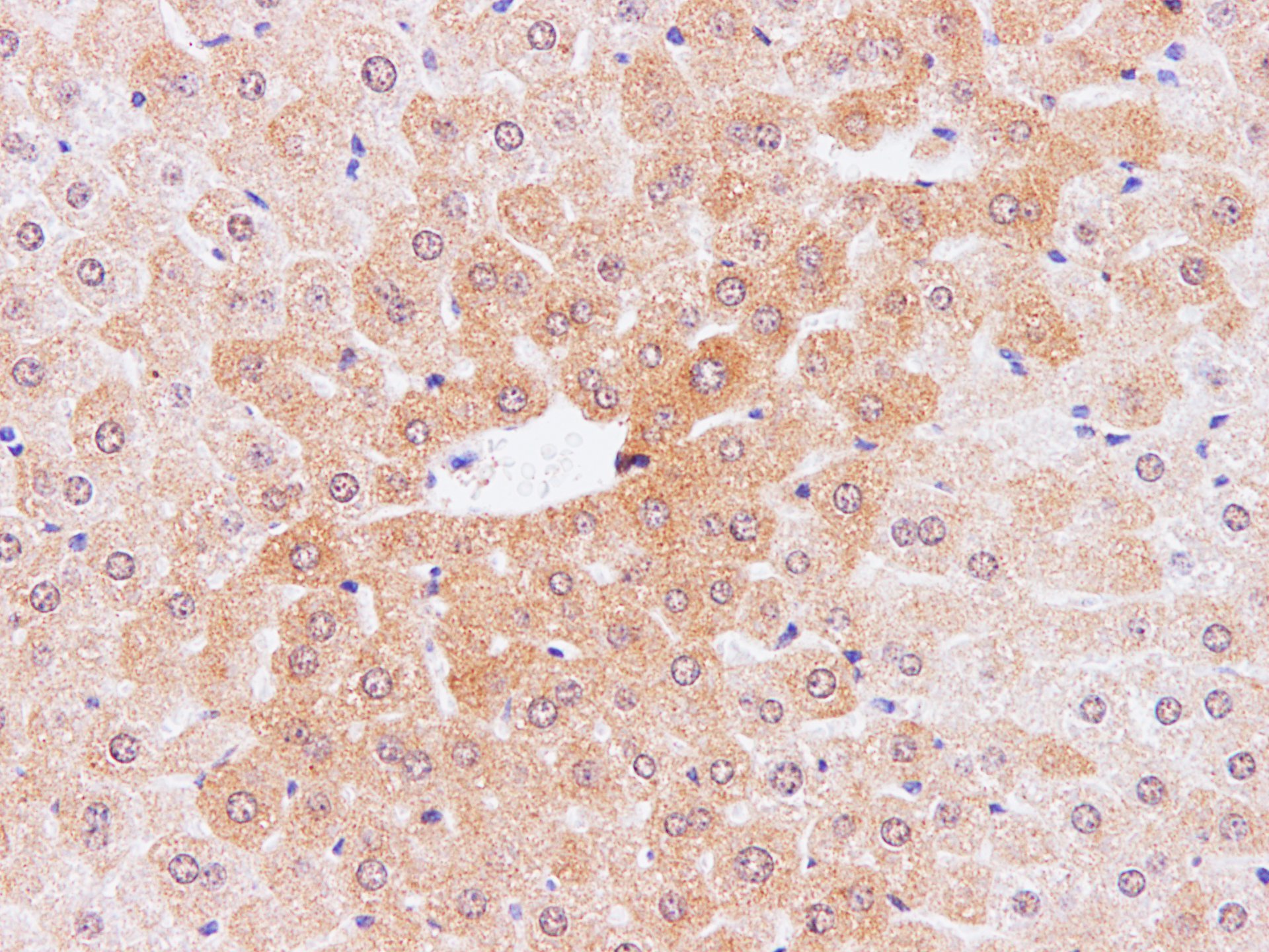 Immunohistochemistry of paraffin-embedded Mouse liver using IL2 Polyclonal Antibody at dilution of 1:100