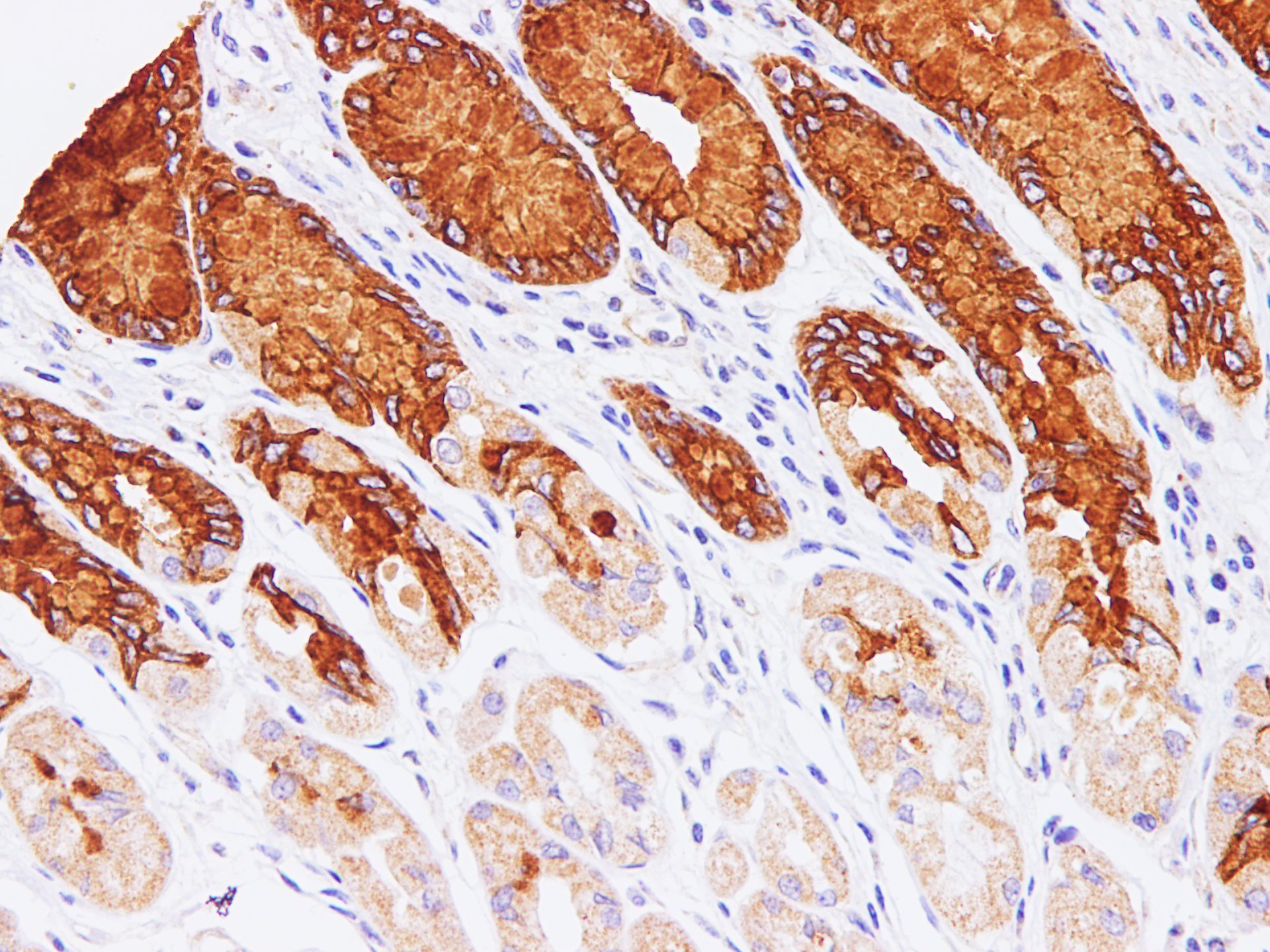 Immunohistochemistry of paraffin-embedded Human stomach using MUC5AC Polyclonal Antibody at dilution of 1:100(400×)