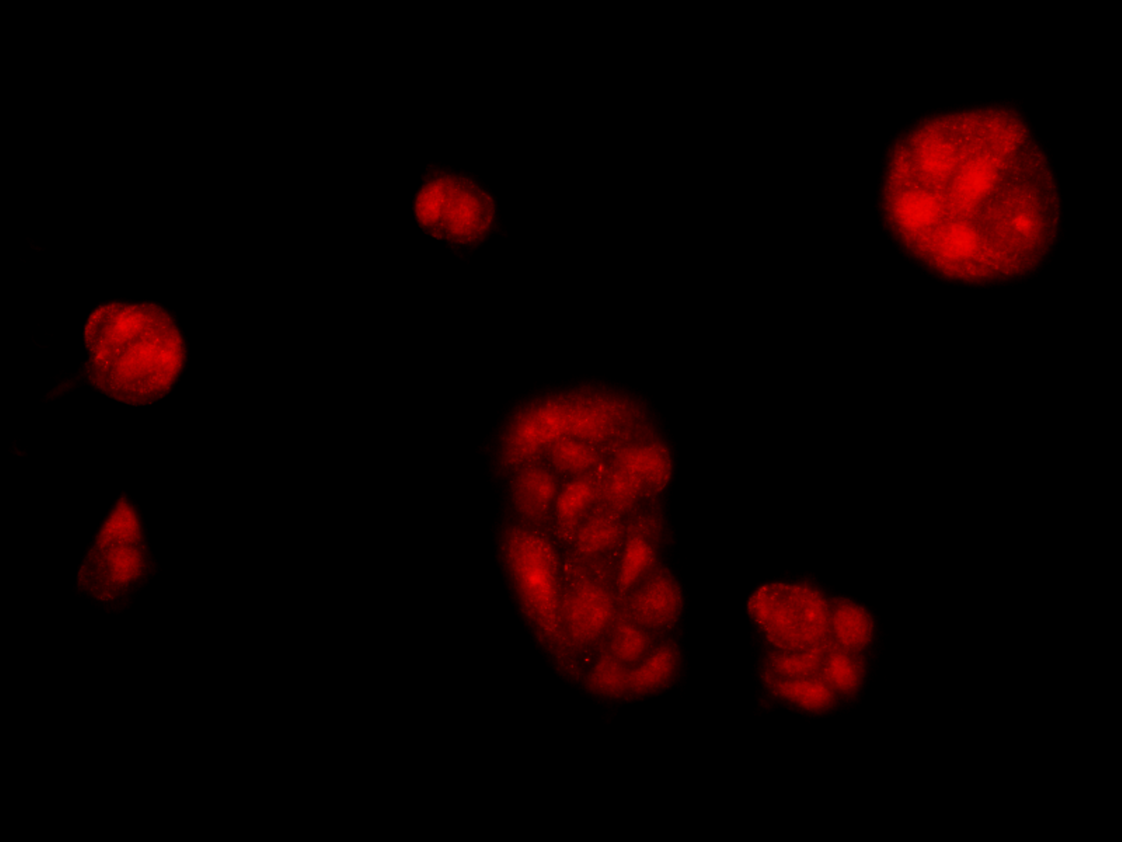 Immunofluorescence analysis of McF7 cells  using BRCA1 Polyclonal Antibody at dilution of 1:100