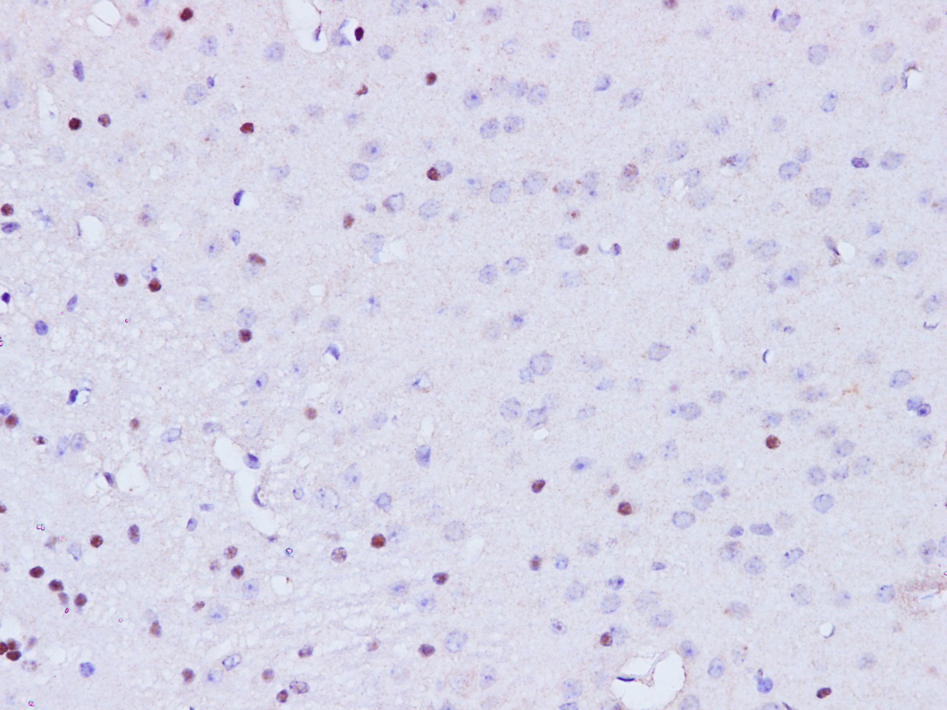 Immunohistochemistry of paraffin-embedded Mouse brain  using BRCA1 Polyclonal Antibody at dilution of 1:100