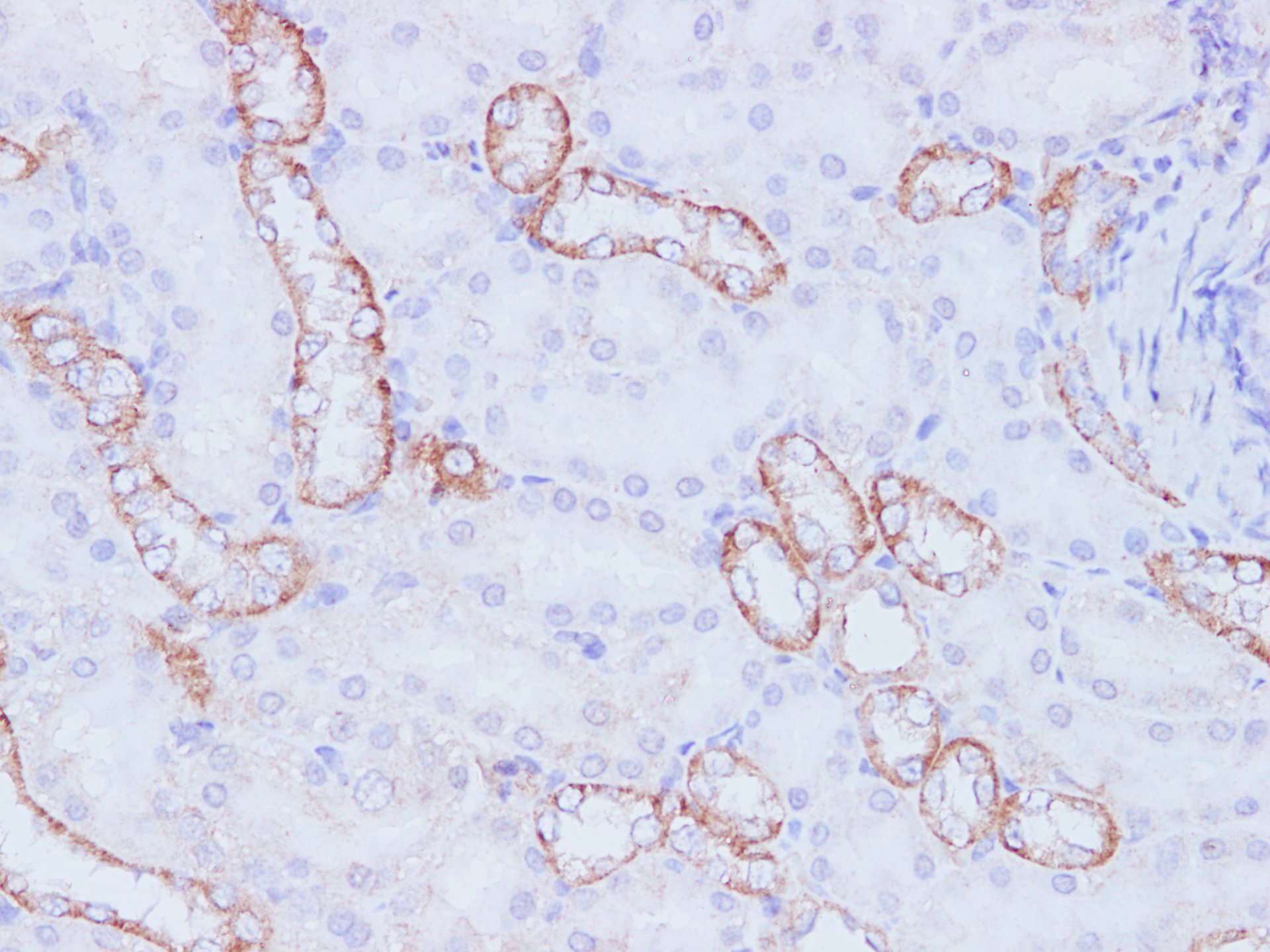 Immunohistochemistry of paraffin-embedded Rat kidney using PI 3 kinase p110 alpha Polyclonal Antibody at dilution of 1:100