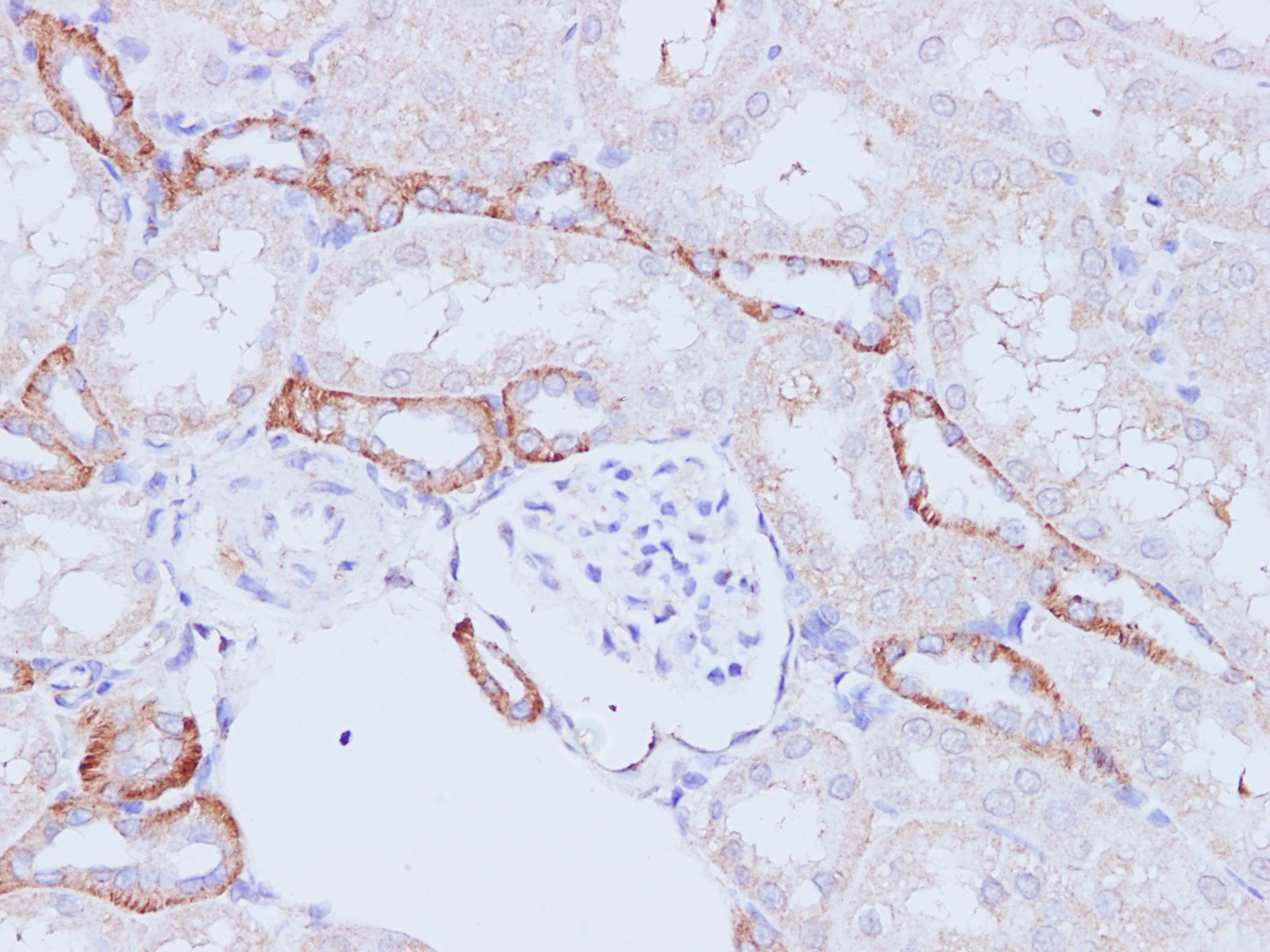 Immunohistochemistry of paraffin-embedded Rat kidney using PI 3 kinase p110 alpha Polyclonal Antibody at dilution of 1:100