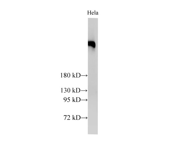 Western Blot analysis of Hela cells  using BRCA2 Polyclonal Antibody at dilution of 1:2000