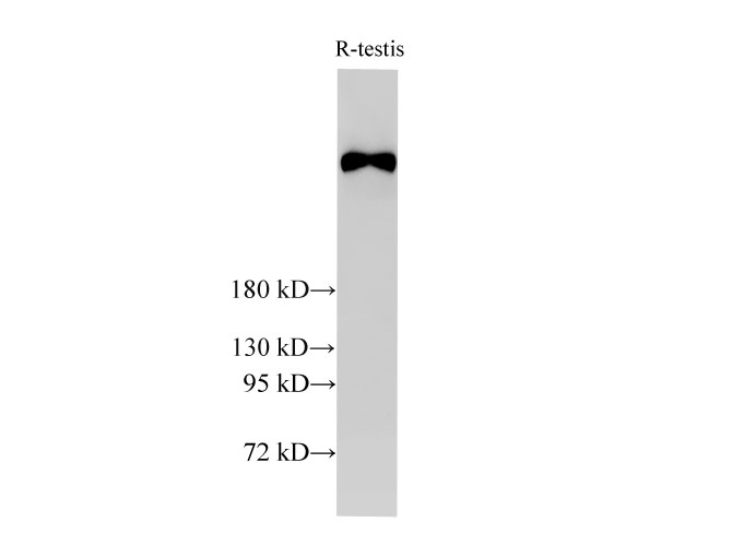 Western Blot analysis of Rat testis  using BRCA2 Polyclonal Antibody at dilution of 1:2000