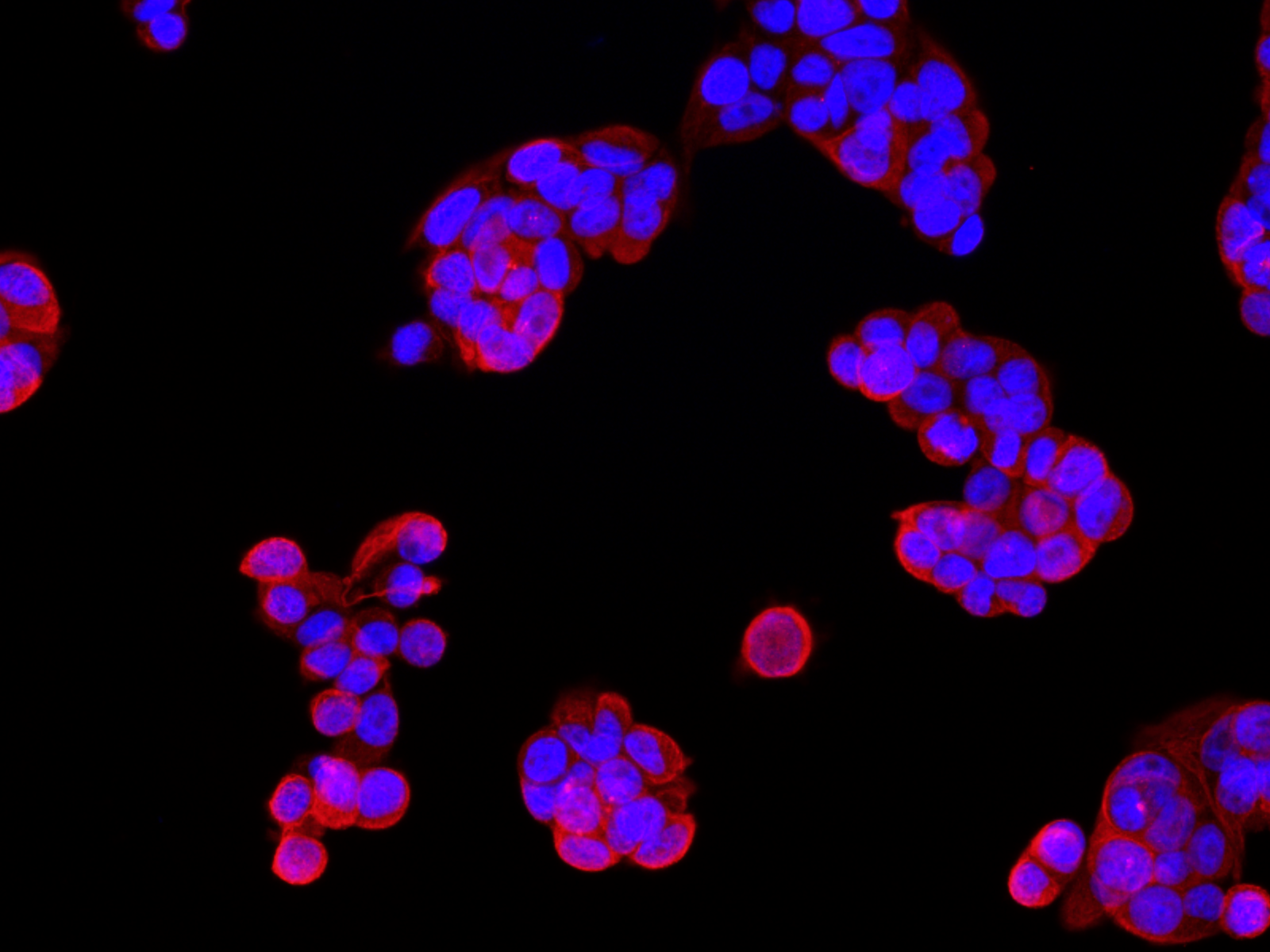 Immunofluorescence analysis of McF7 cells  using AFP Polyclonal Antibody at dilution of 1:100