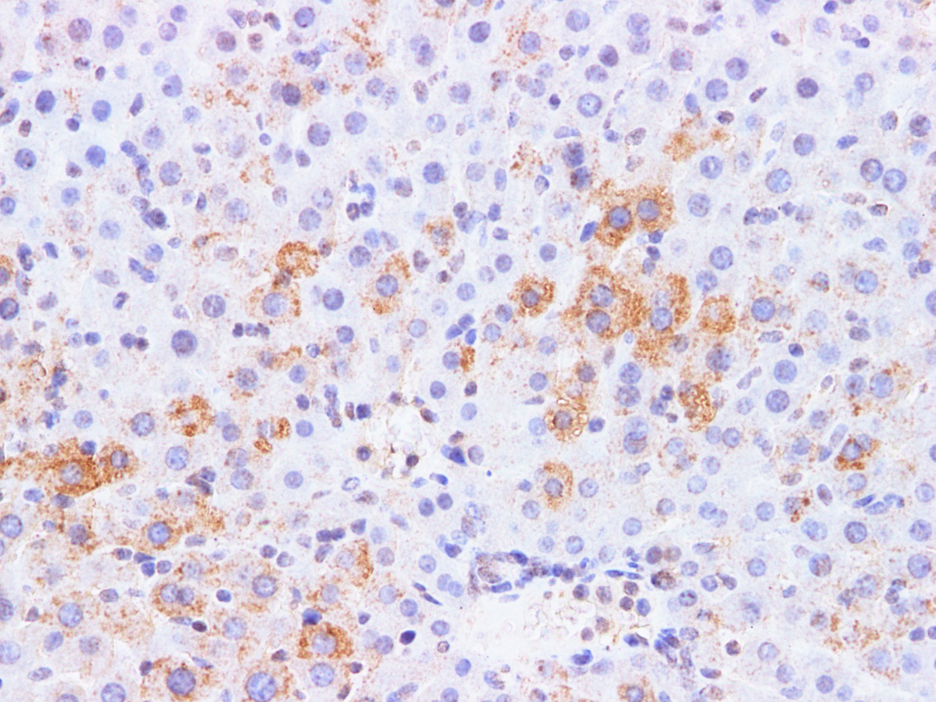 Immunohistochemistry of paraffin-embedded Mouse liver using AFP Polyclonal Antibody at dilution of 1:50
