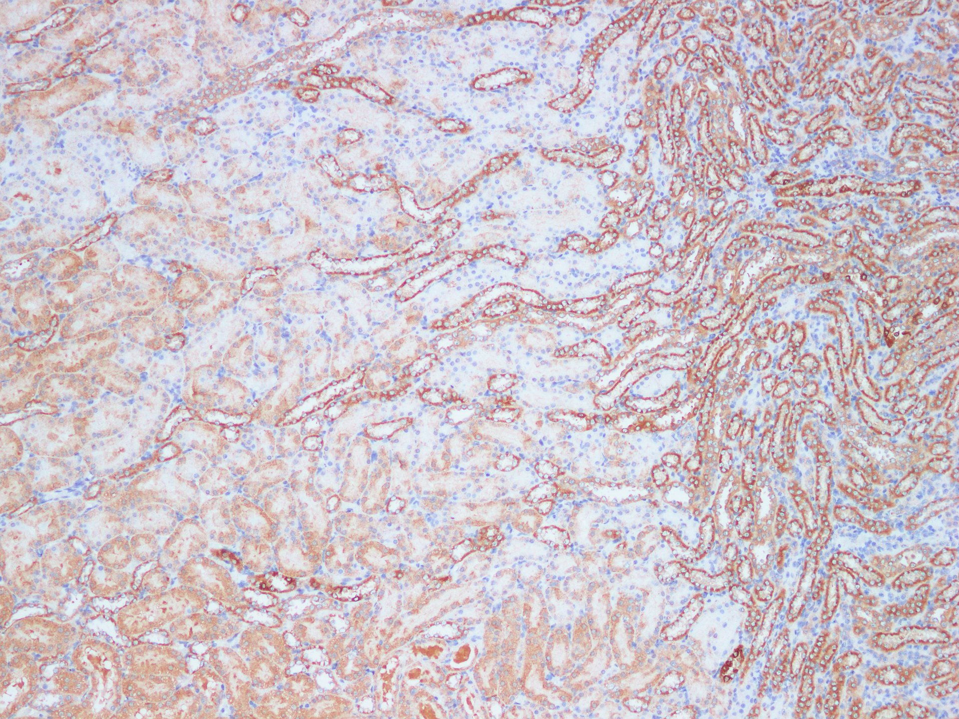 Immunohistochemistry of paraffin-embedded Rat kidney using KLK10 Polyclonal Antibody Antibody at dilution of 1:200(1×100)