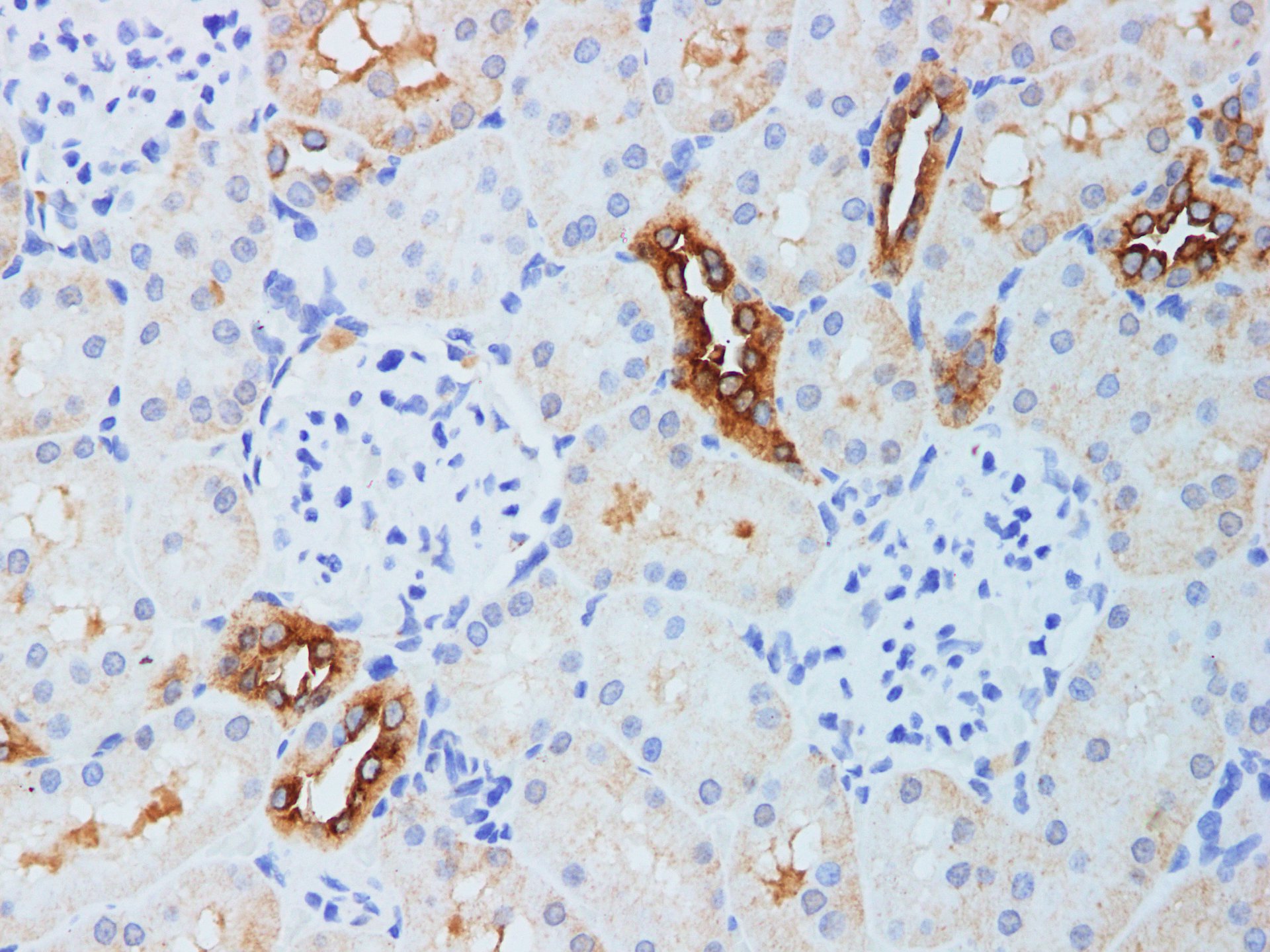 Immunohistochemistry of paraffin-embedded Rat kidney using KLK10 Polyclonal Antibody Antibody at dilution of 1:200(1×400)