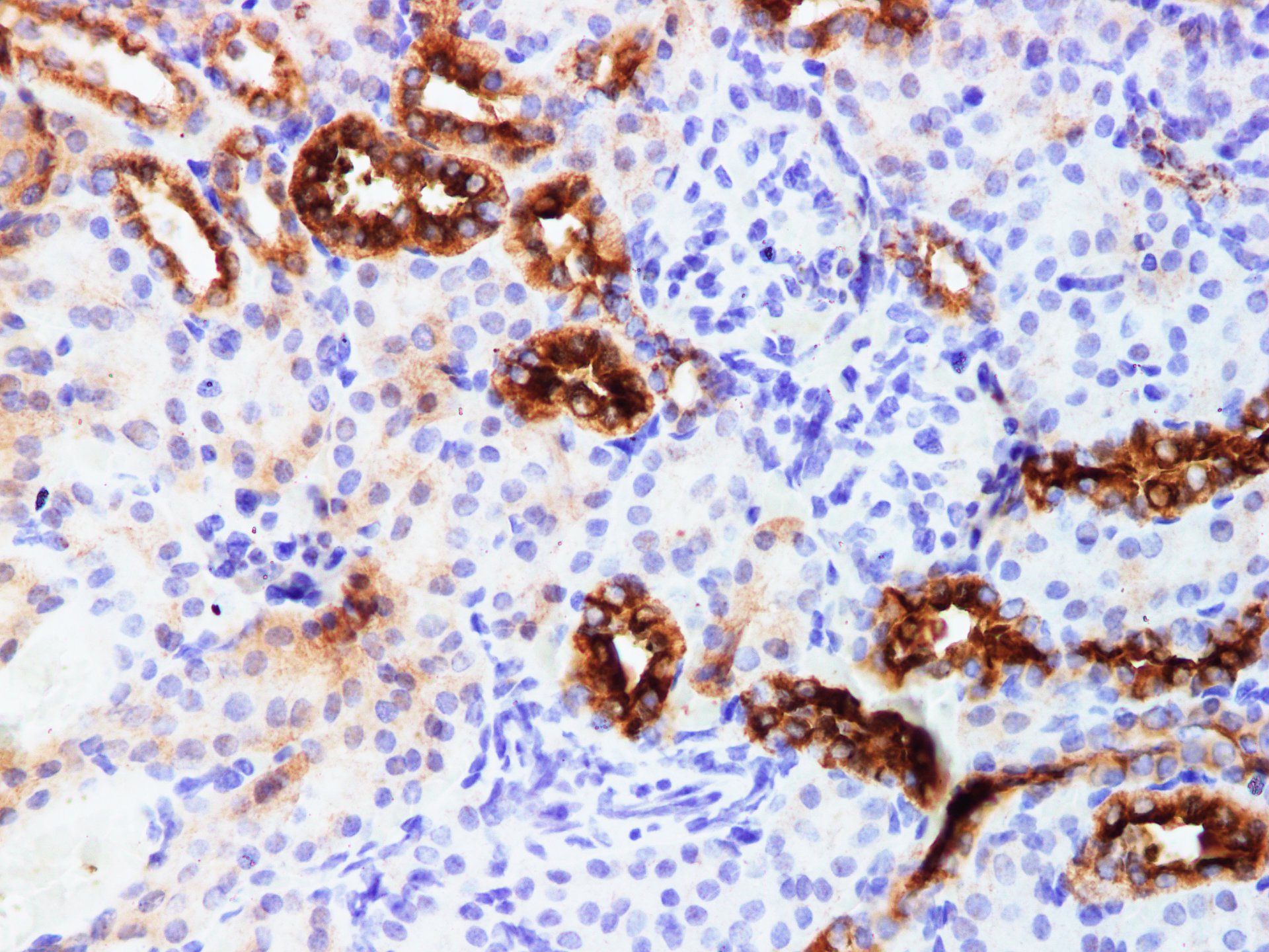 Immunohistochemistry of paraffin-embedded Mouse kidney using KLK10 Polyclonal Antibody Antibody at dilution of 1:200