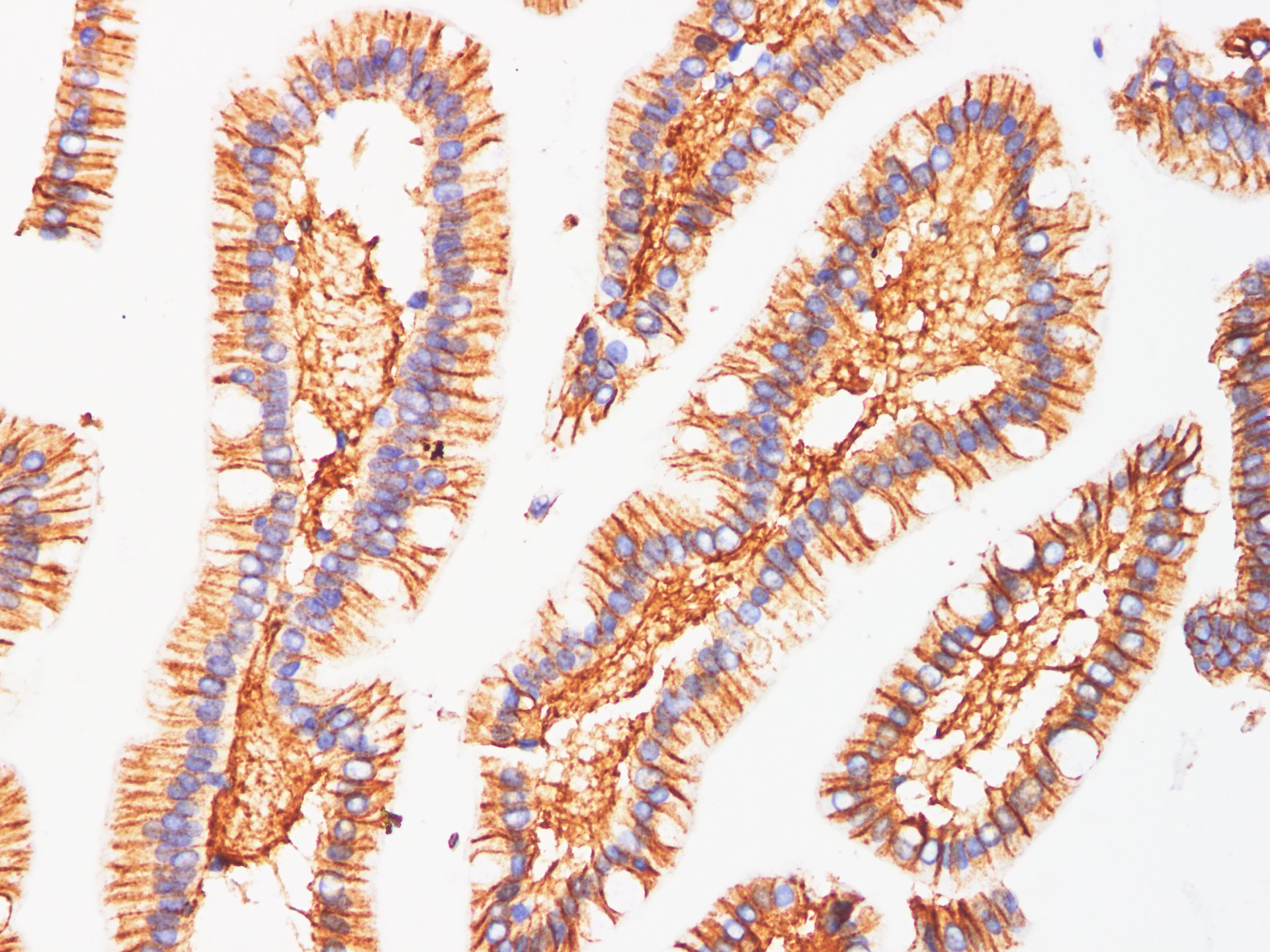 Immunohistochemistry of paraffin-embedded Human Duodenum using EpCAM Polyclonal Antibody at dilution of 1:100(400×)