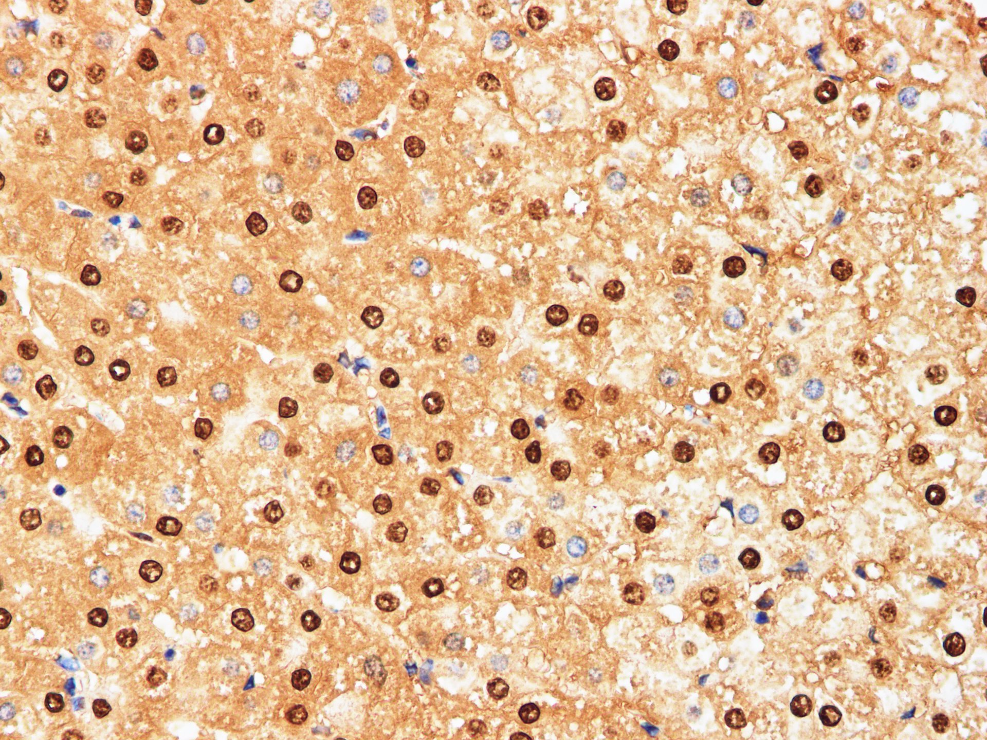 Immunohistochemistry of paraffin-embedded Human liver using HSPA1A Polyclonal Antibody at dilution of 1:200