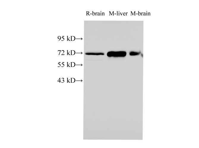 Western Blot analysis of Rat brain, Mouse liver and Mouse brain tissues using HSPA1A Polyclonal Antibody at dilution of 1:1000