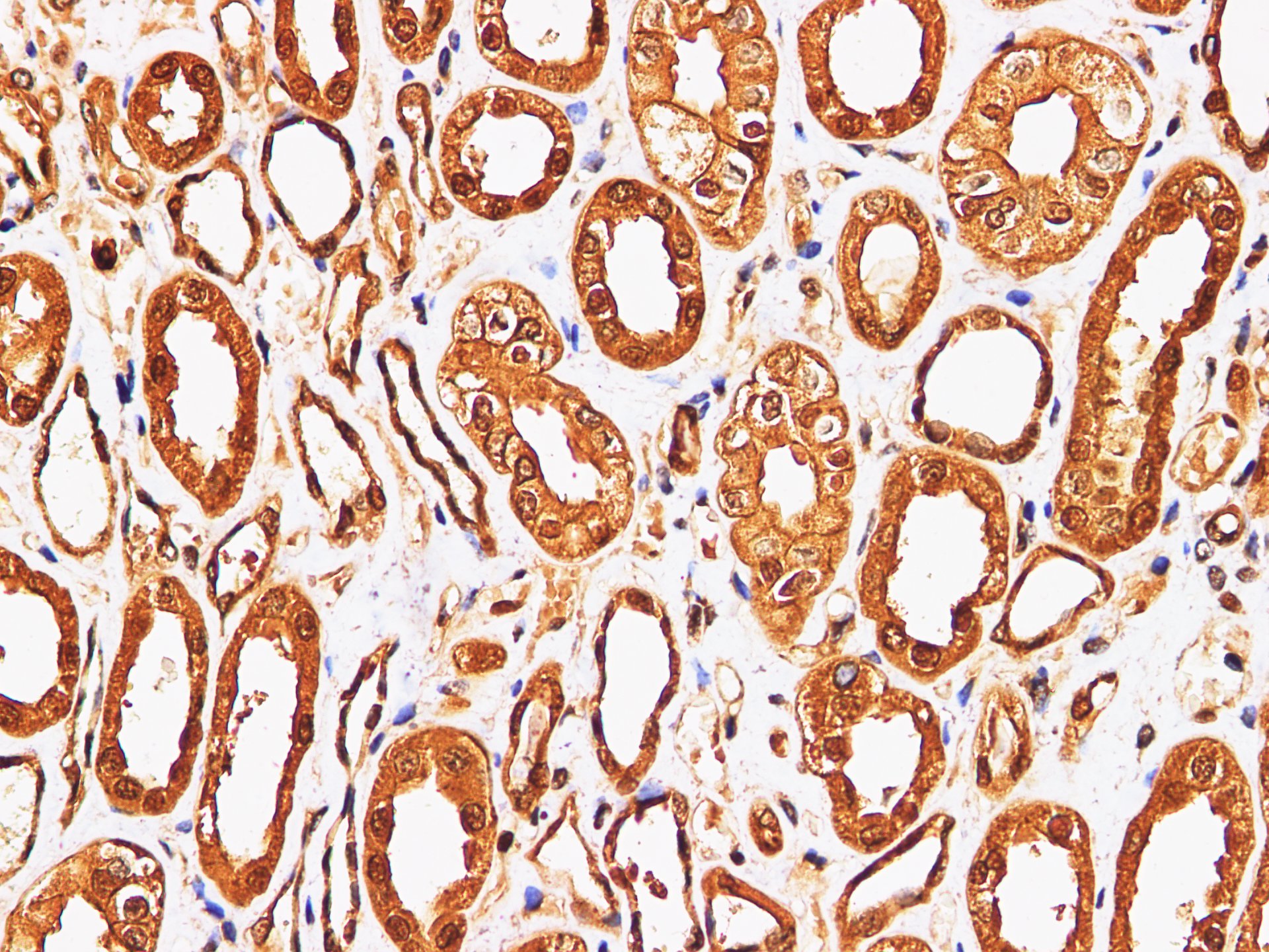 Immunohistochemistry of paraffin-embedded Human kidney using S100A9 Polyclonl Antibody at dilution of 1:200.