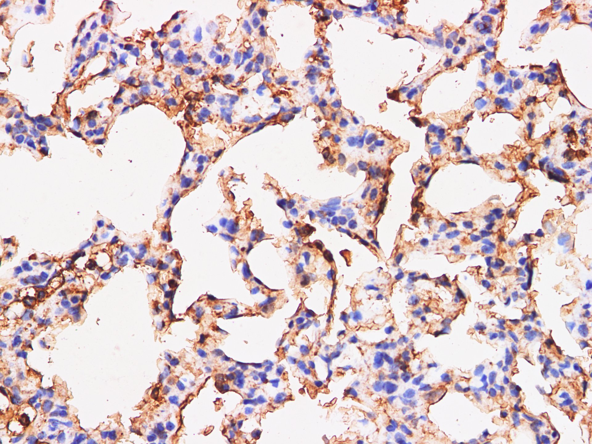 Immunohistochemistry of paraffin-embedded Rat lung using S100A9 Polyclonl Antibody at dilution of 1:200.