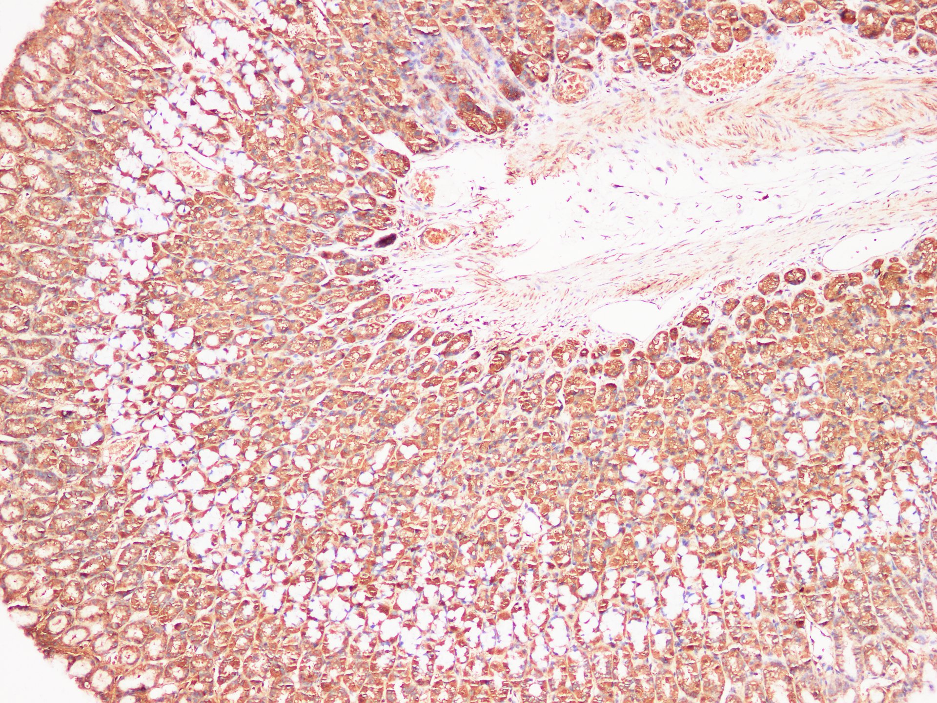 Immunohistochemistry of paraffin-embedded Rat stomach using S100A9 Polyclonl Antibody at dilution of 1:200（100×）.