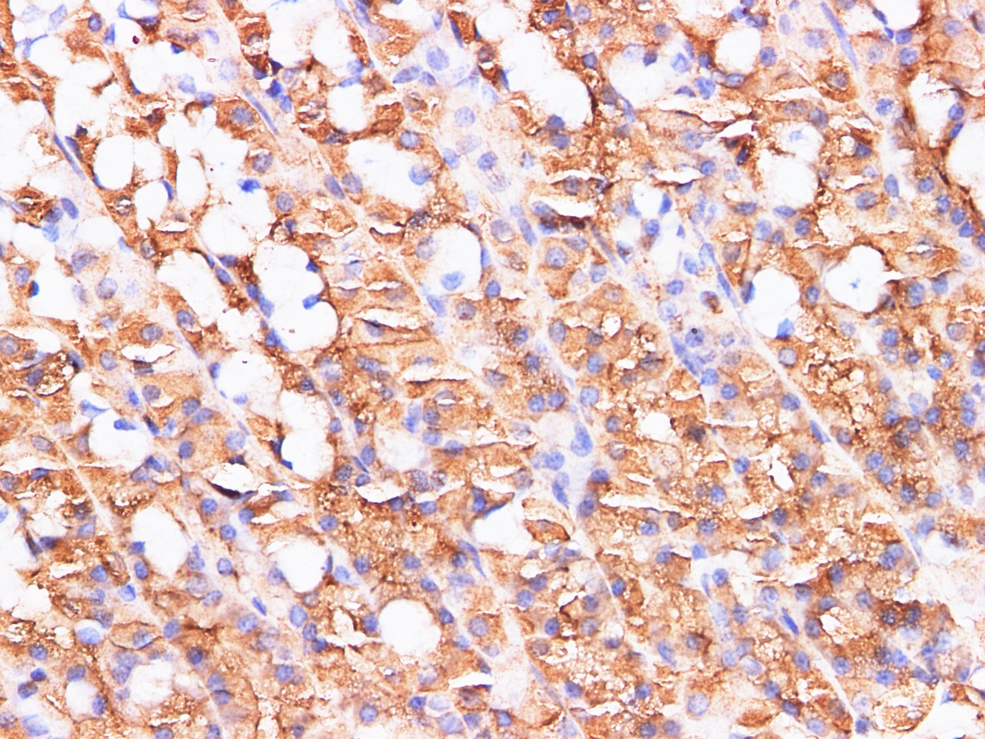 Immunohistochemistry of paraffin-embedded Rat stomach using S100A9 Polyclonl Antibody at dilution of 1:200（400×）.