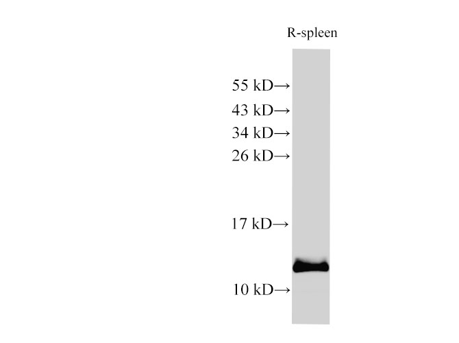 Western Blot analysis of Rat spleen using S100A9 Polyclonl Antibody at dilution of 1:1000.