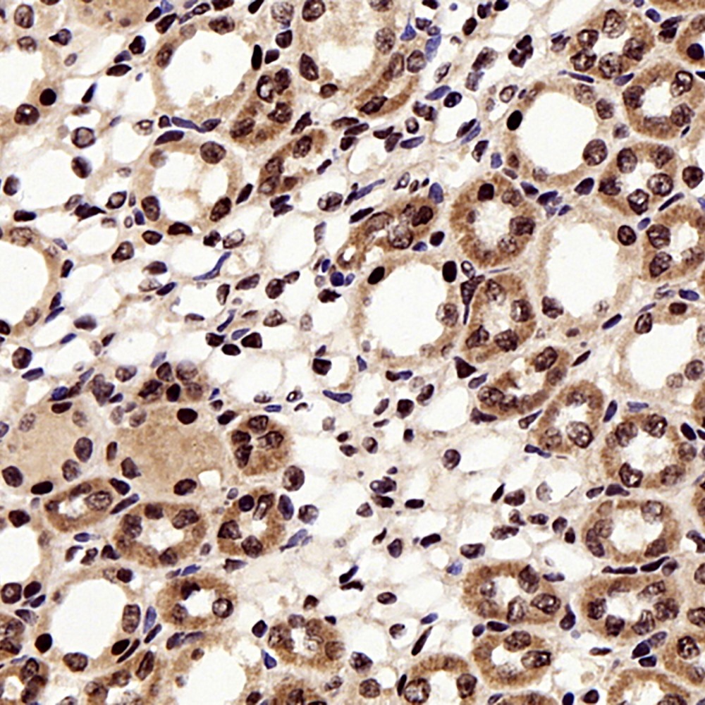 Immunohistochemistry analysis of paraffin-embedded Rat kidney  using P38 Polyclonal Antibody at dilution of 1:500.