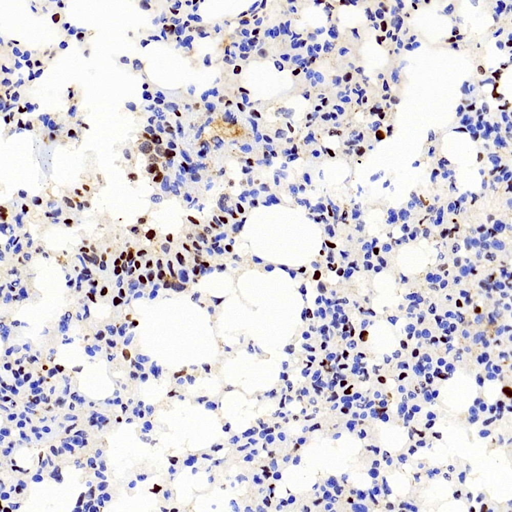 Immunohistochemistry analysis of paraffin-embedded Mouse lung  using Proliferating Cell Nuclear Antigen Polyclonal Antibody at dilution of 1:300.