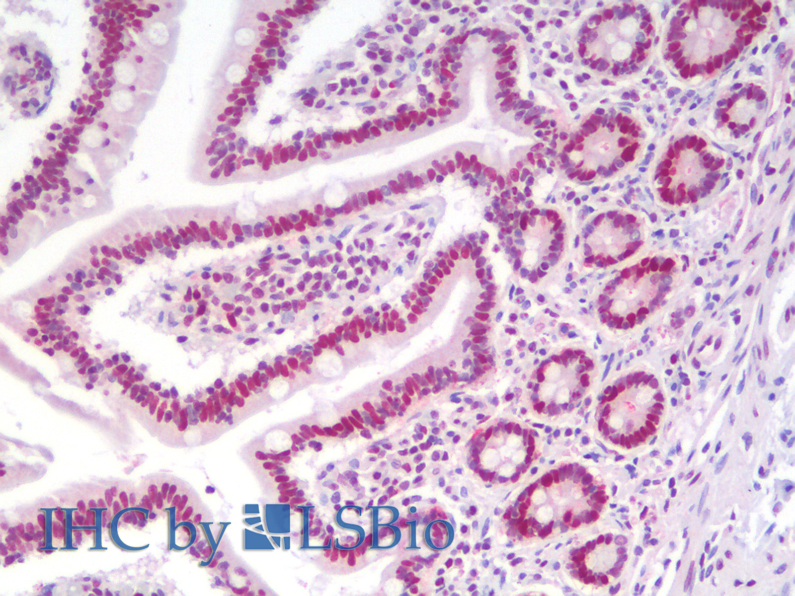 Immunohistochemistry analysis of paraffin-embedded Human SmallIntestine using PCNA Polyclonal Antibody.