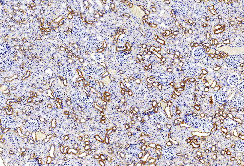 Immunohistochemistry analysis of paraffin-embedded Mosue kidney  using Catenin beta Polyclonal Antibody at dilution of 1:500.