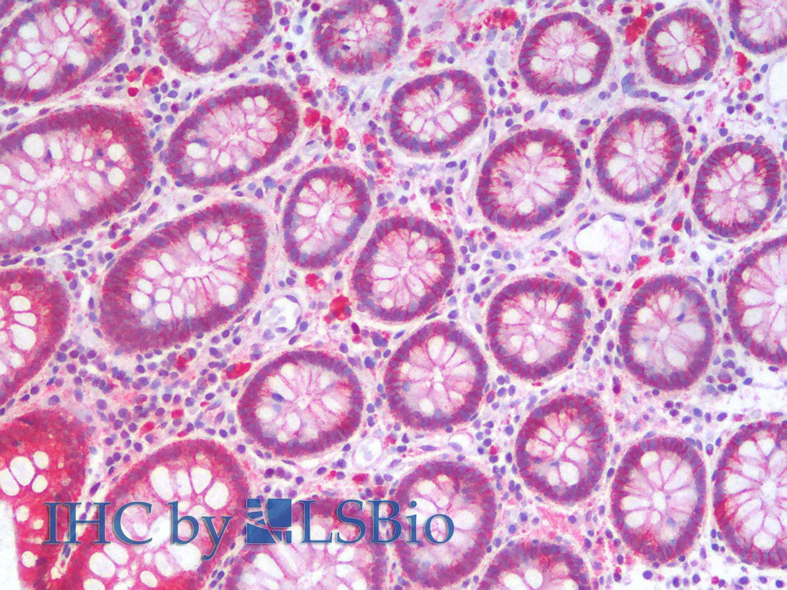 Immunohistochemistry analysis of paraffin-embedded Human Colon using Catenin beta Polyclonal Antibody.