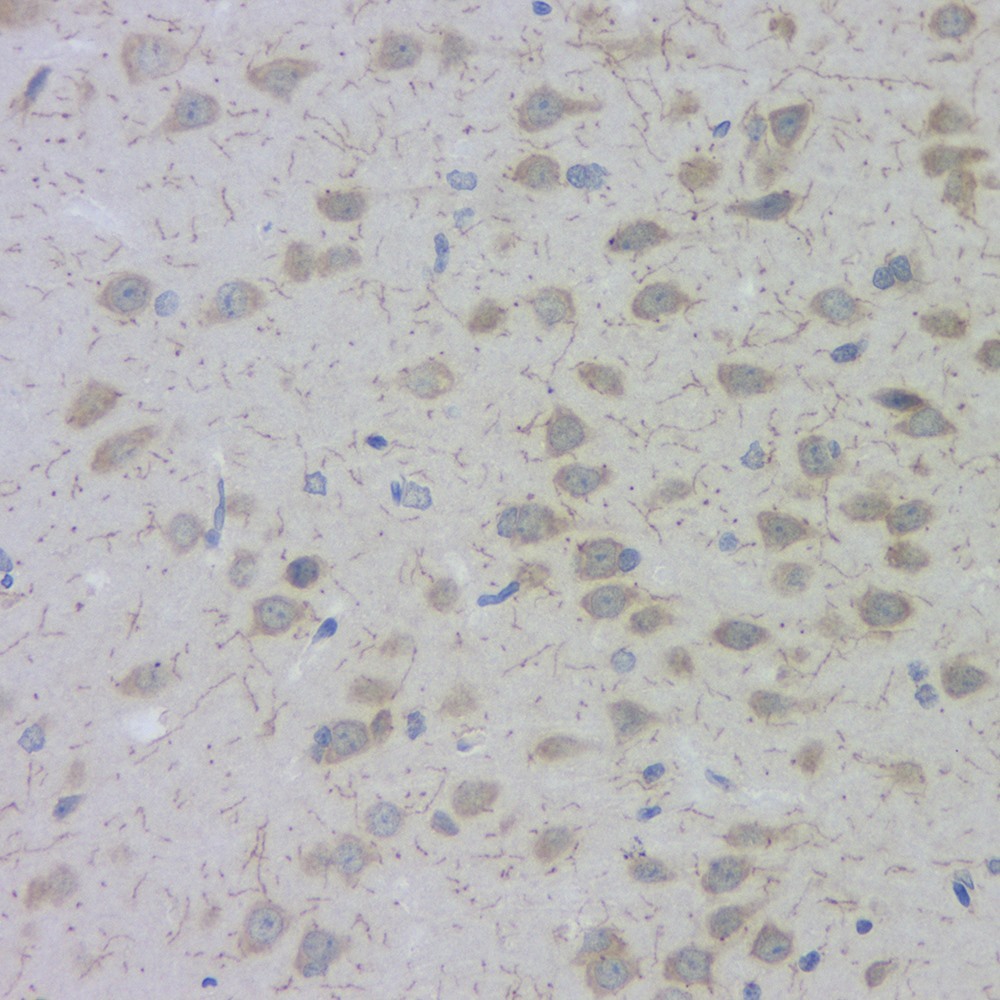 Immunohistochemistry analysis of paraffin-embedded rat brain  using ACHE Polyclonal Antibody at dilution of 1:300.