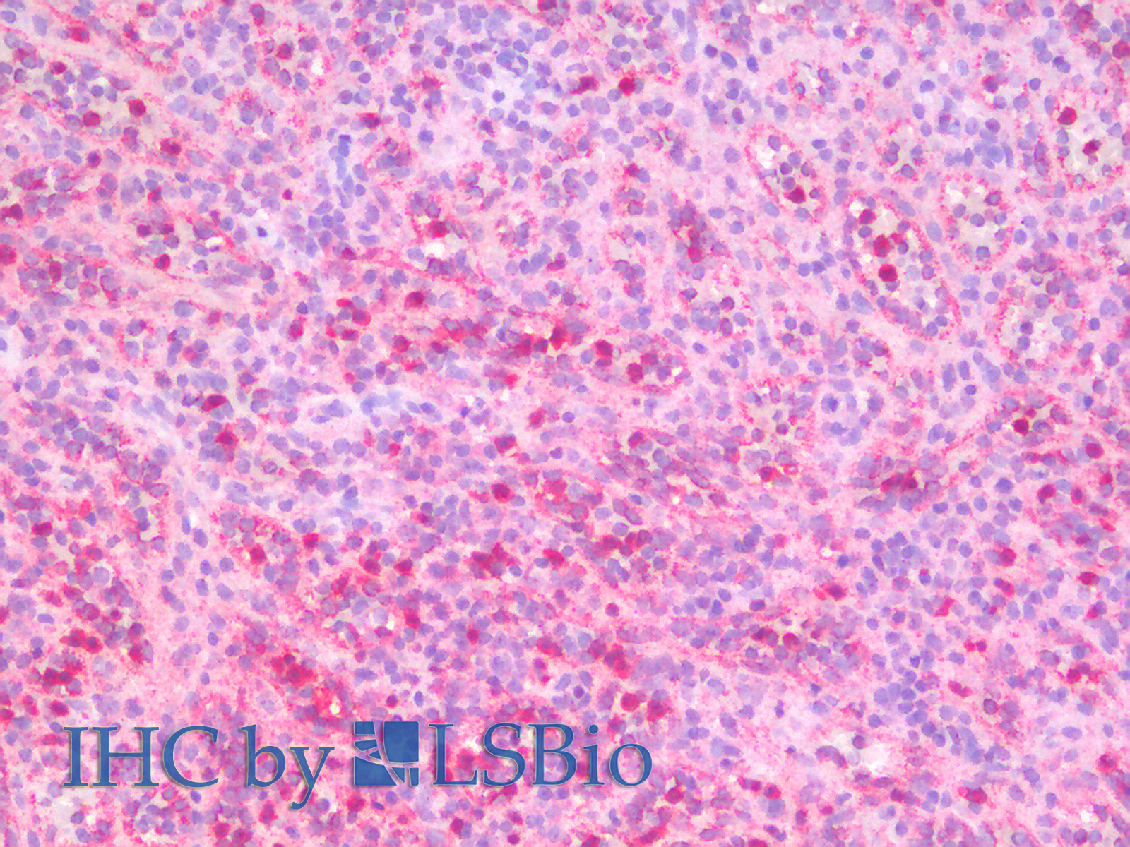 Immunohistochemistry analysis of paraffin-embedded Human Spleen using ITGAX Polyclonal Antibody.