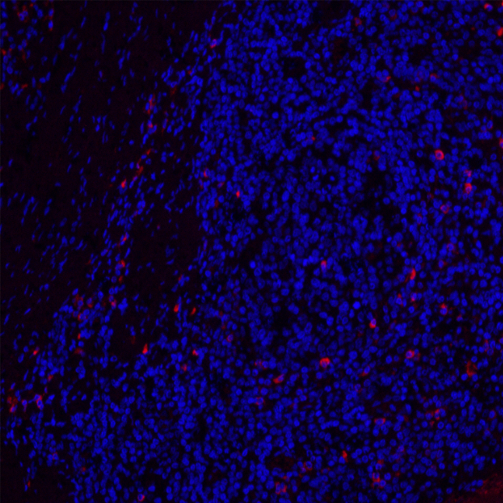 Immunofluorescence analysis of paraffin-embedded Human tonsil  using CD19 Polyclonal Antibody at dilution of 1:200.