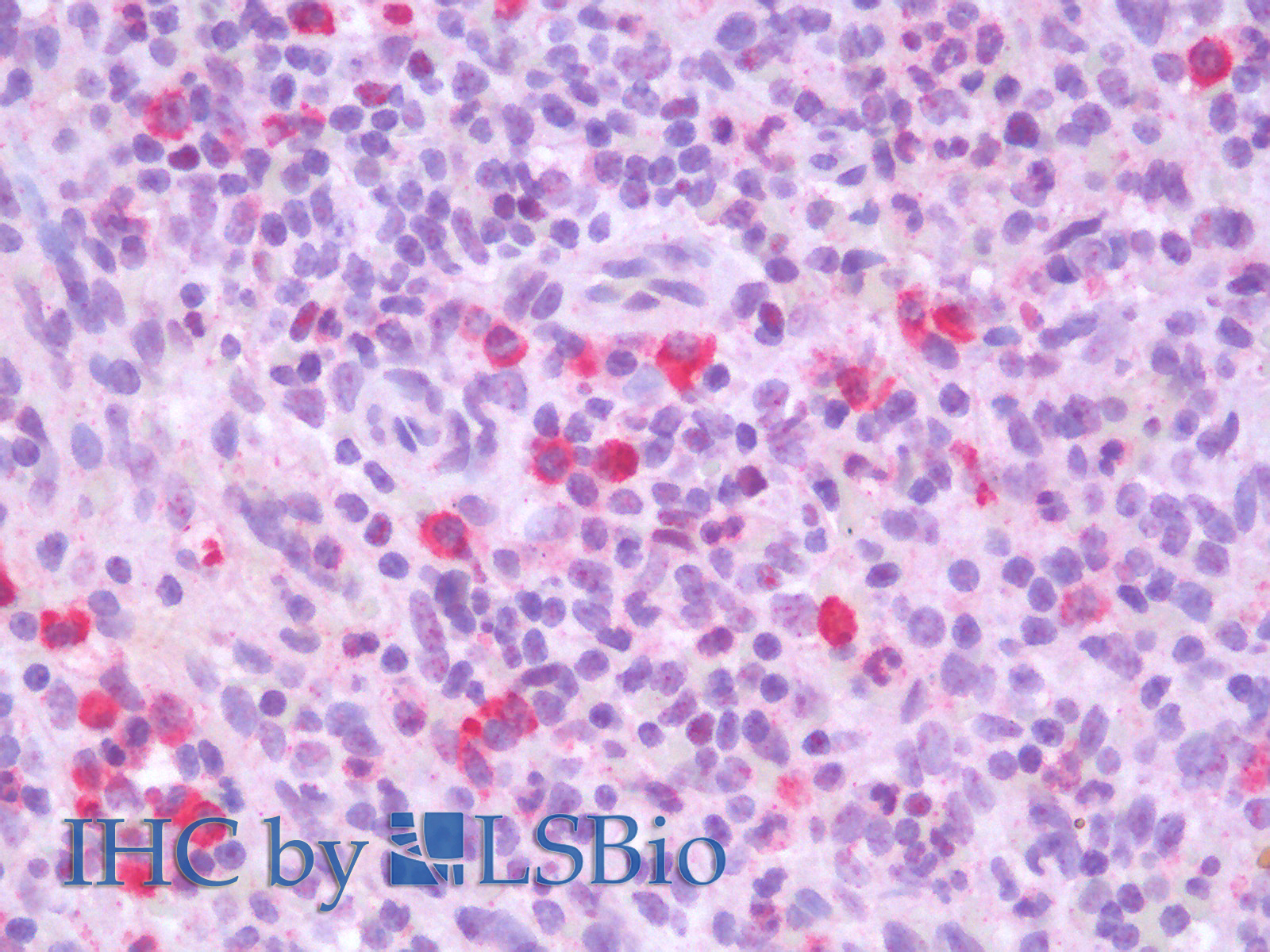 Immunohistochemistry analysis of paraffin-embedded Human Spleen using CD19 Polyclonal Antibody.