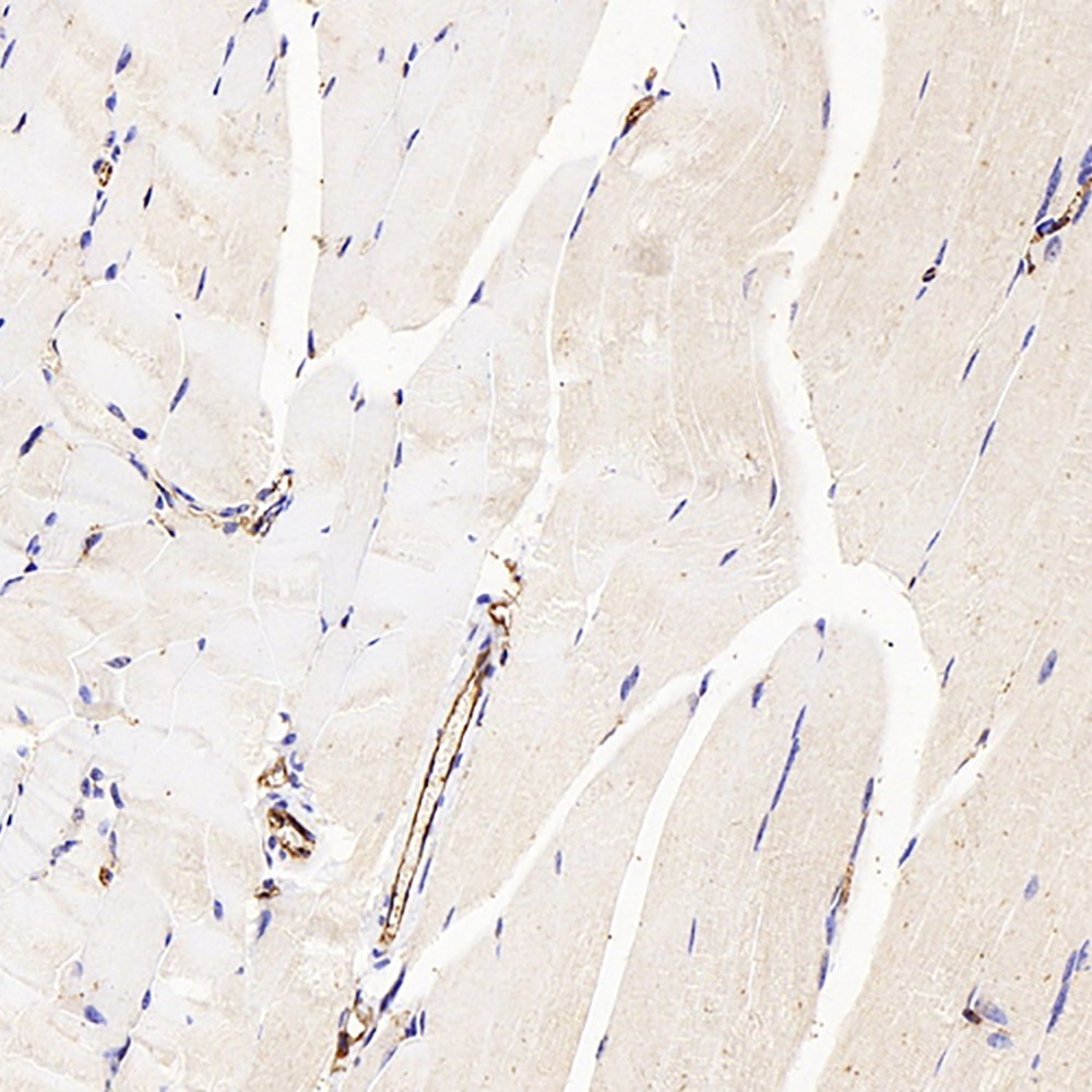 Immunohistochemistry analysis of paraffin-embedded mouse skeletal muscle  using CD31 Polyclonal Antibody at dilution of 1:300.