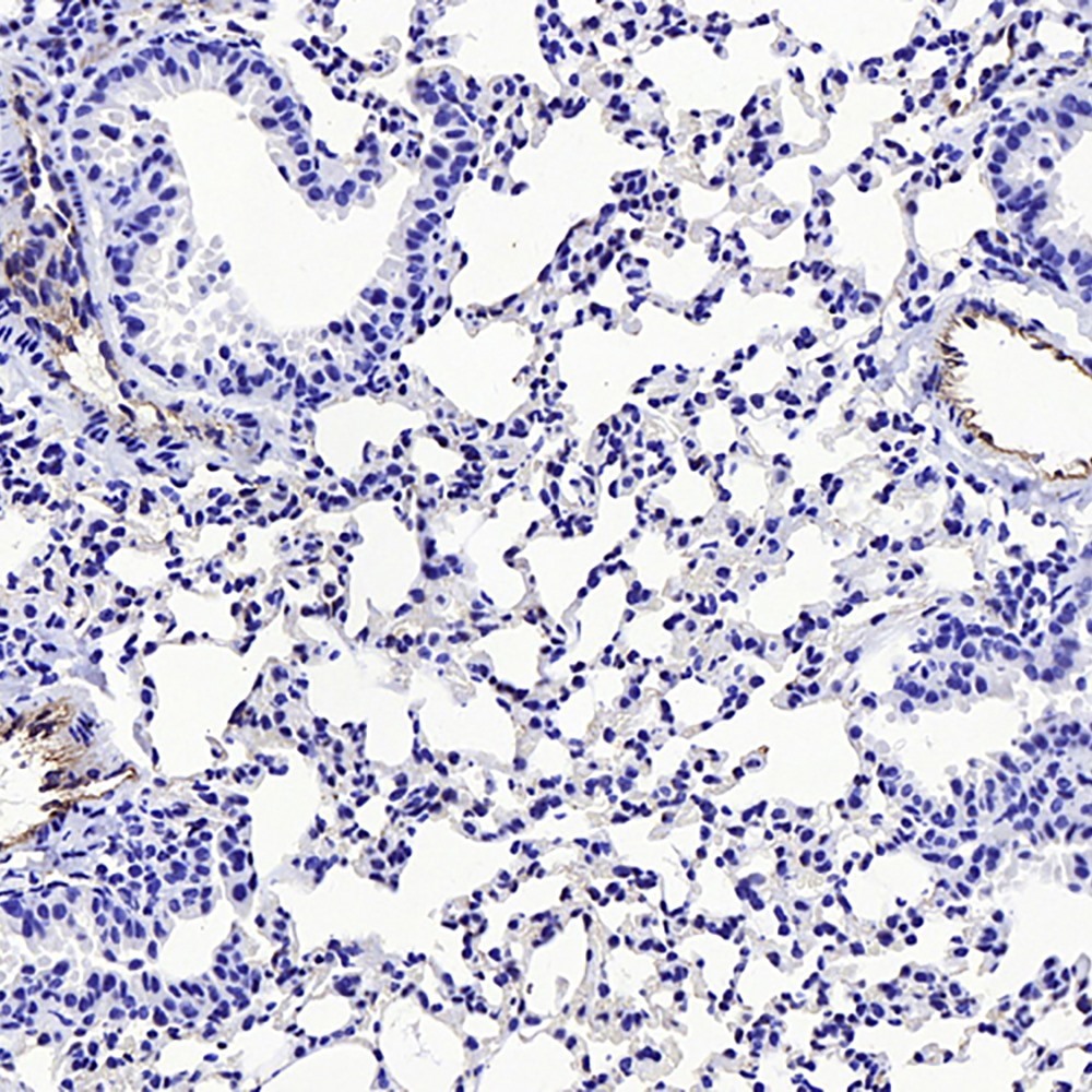 Immunohistochemistry analysis of paraffin-embedded mouse lung cancer  using CD31 Polyclonal Antibody at dilution of 1:300.