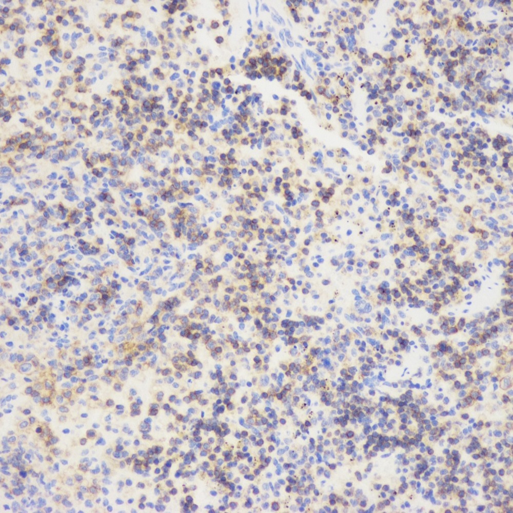 Immunohistochemistry analysis of paraffin-embedded mouse inflammatory spleen  using CD45 Polyclonal Antibody at dilution of 1:1000.