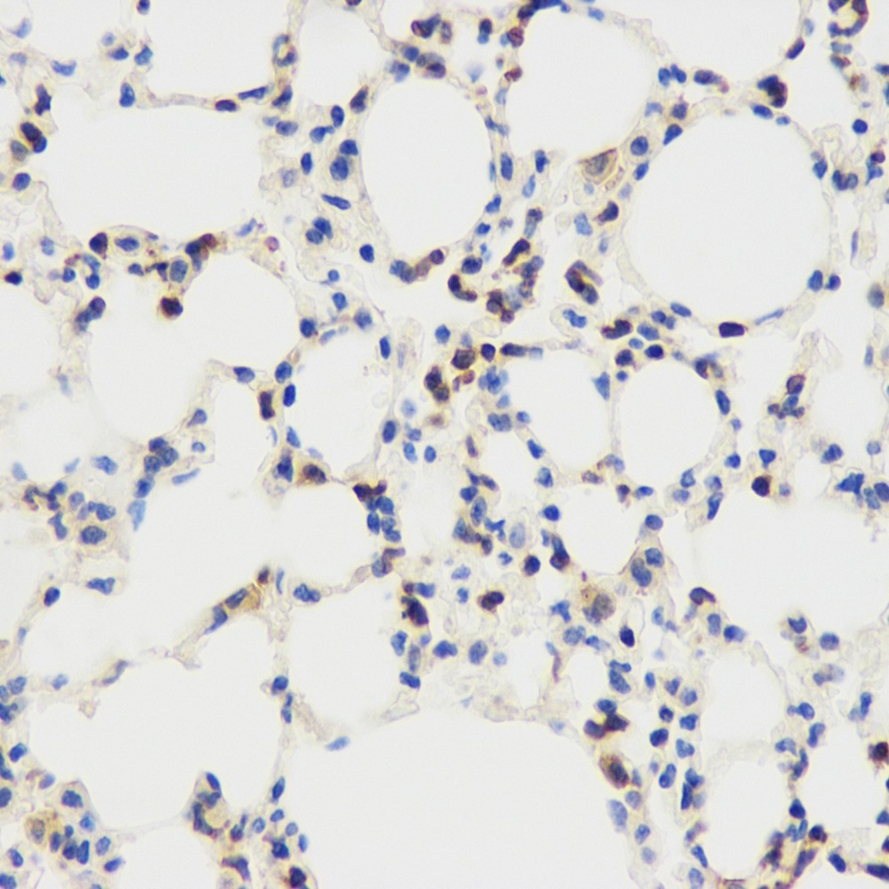 Immunohistochemistry analysis of paraffin-embedded mouse lungs using CD45 Polyclonal Antibody at dilution of 1:1000.