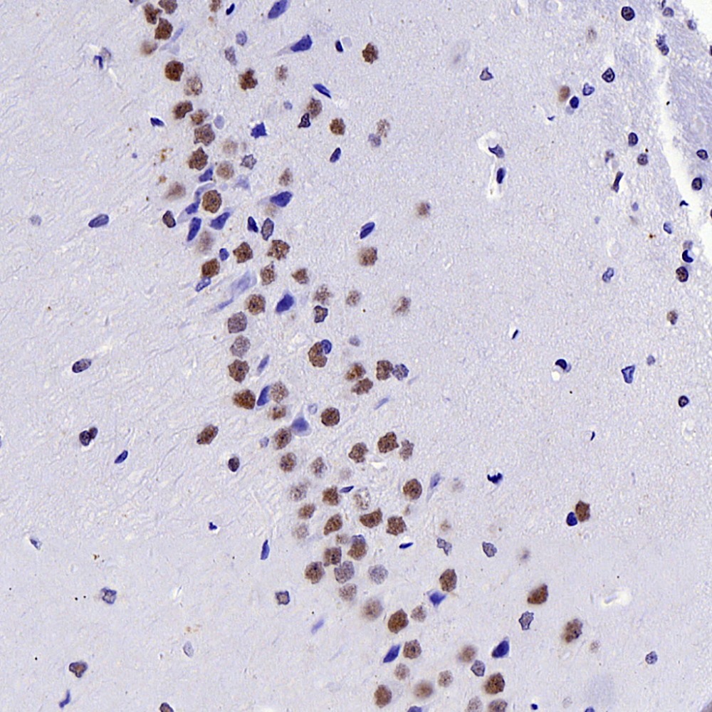 Immunohistochemistry analysis of paraffin-embedded Rat brain  using c-Fos Polyclonal Antibody at dilution of 1:200.