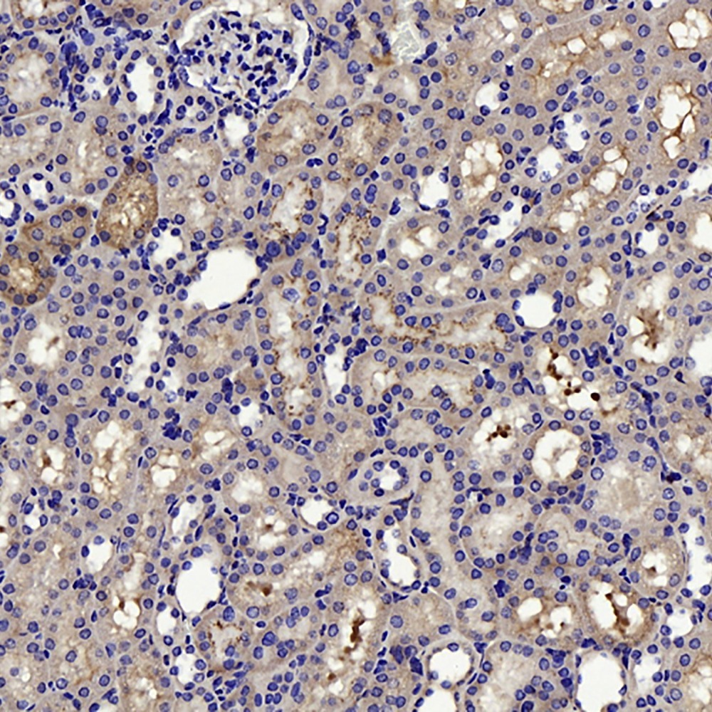 Immunohistochemistry analysis of paraffin-embedded mouse kidney  using CTGF Polyclonal Antibody at dilution of 1:100.