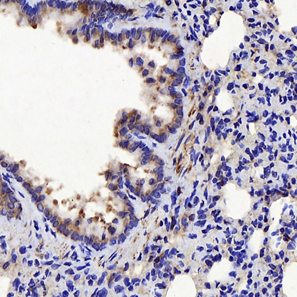 Immunohistochemistry analysis of paraffin-embedded rat lung  using CTGF Polyclonal Antibody at dilution of 1:100.