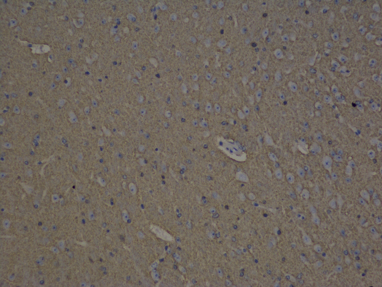 Immunohistochemistry analysis of paraffin-embedded mouse brain  using GAP43 Polyclonal Antibody at dilution of 1:300.