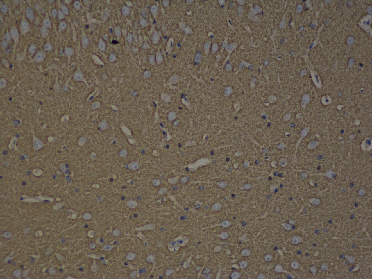 Immunohistochemistry analysis of paraffin-embedded rat brain  using GAP43 Polyclonal Antibody at dilution of 1:300.