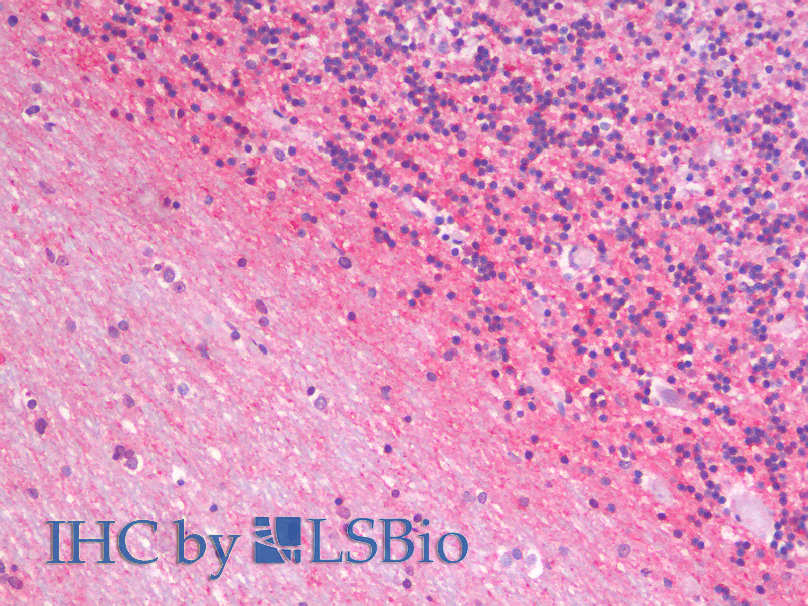 Immunohistochemistry analysis of paraffin-embedded Human Cerebellum using GAP43 Polyclonal Antibody.