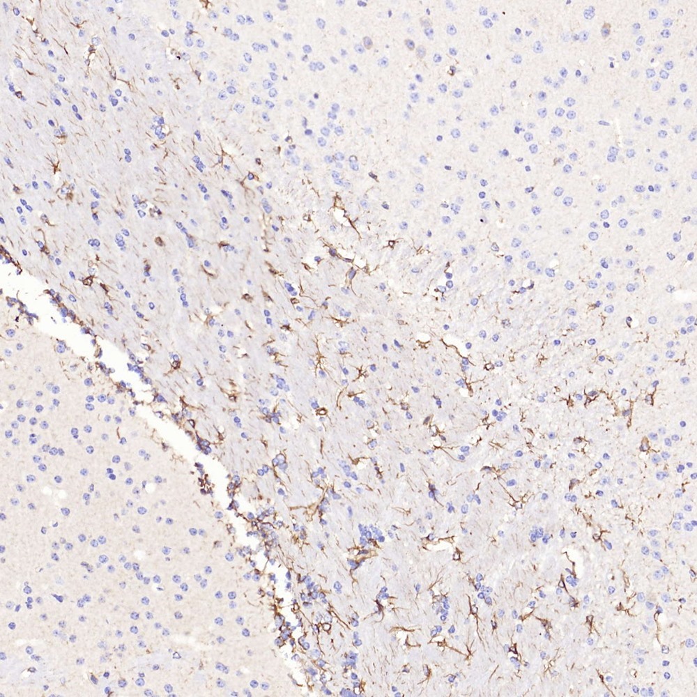 Immunohistochemistry analysis of paraffin-embedded mouse brain  using GFAP Polyclonal Antibody at dilution of 1:500.