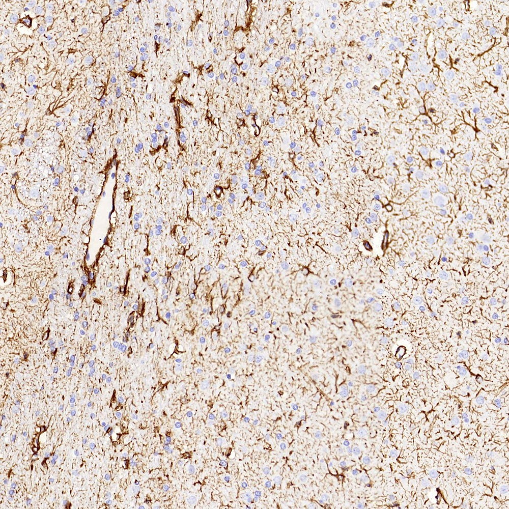 Immunohistochemistry analysis of paraffin-embedded rat brain  using GFAP Polyclonal Antibody at dilution of 1:500.