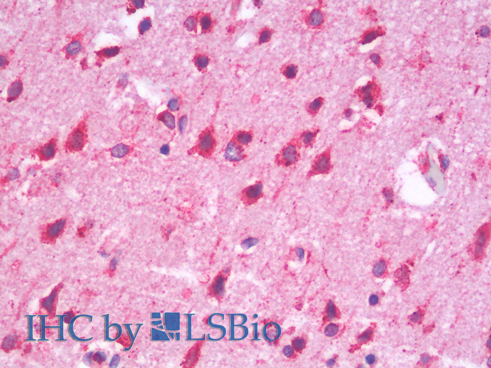 Immunohistochemistry analysis of paraffin-embedded Human Cortex using HSPA5 Polyclonal Antibody.