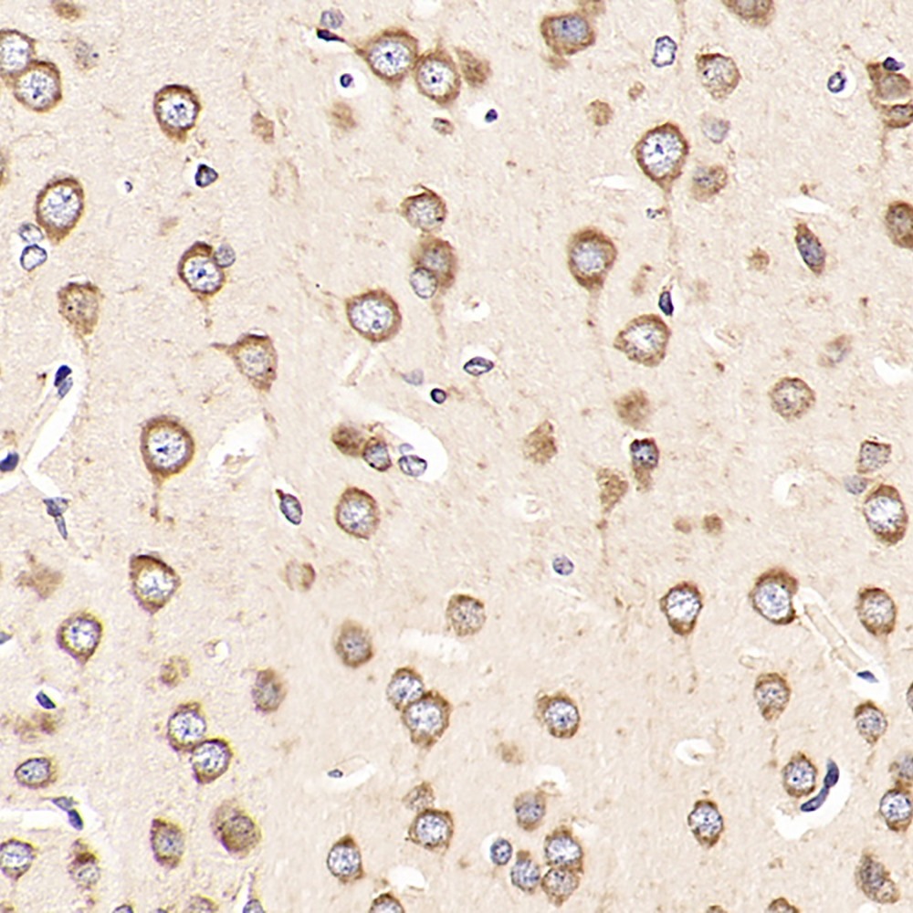 Immunohistochemistry analysis of paraffin-embedded rat brain  using HSPA5 Polyclonal Antibody at dilution of 1:1000.