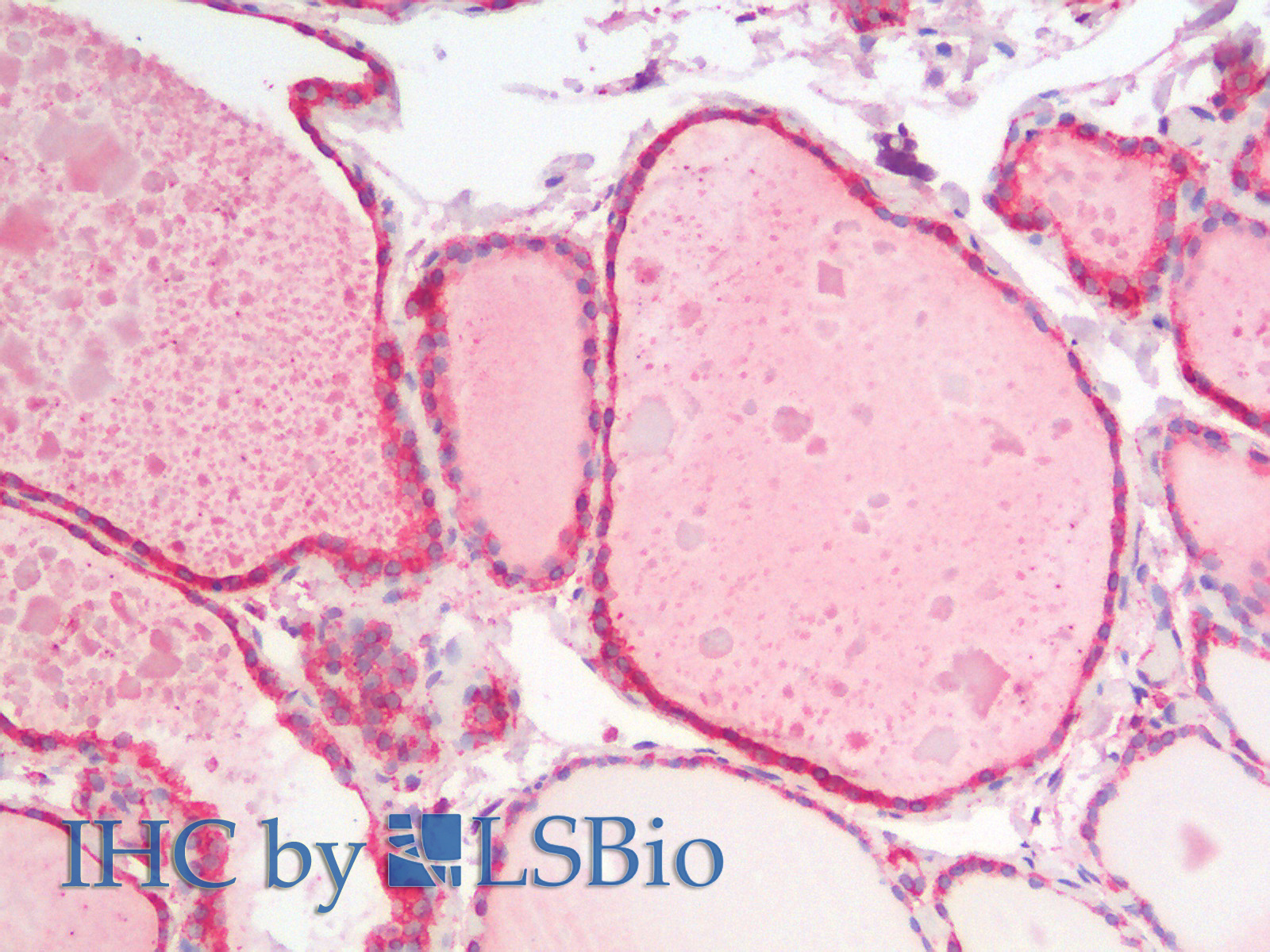 Immunohistochemistry analysis of paraffin-embedded Human Thyroid using HSPA5 Polyclonal Antibody.