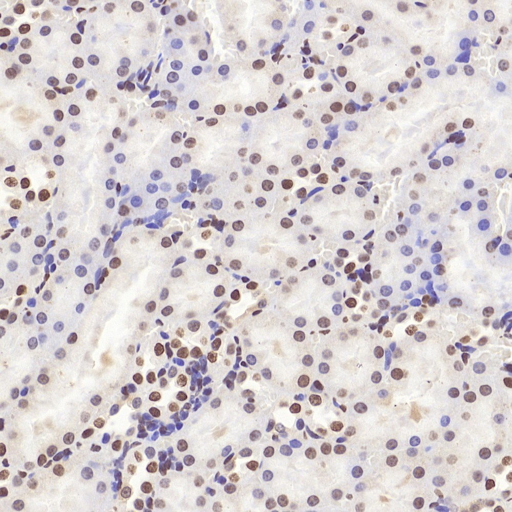 Immunohistochemistry analysis of paraffin-embedded mouse kidney  using HMGB1 Polyclonal Antibody at dilution of 1:500.