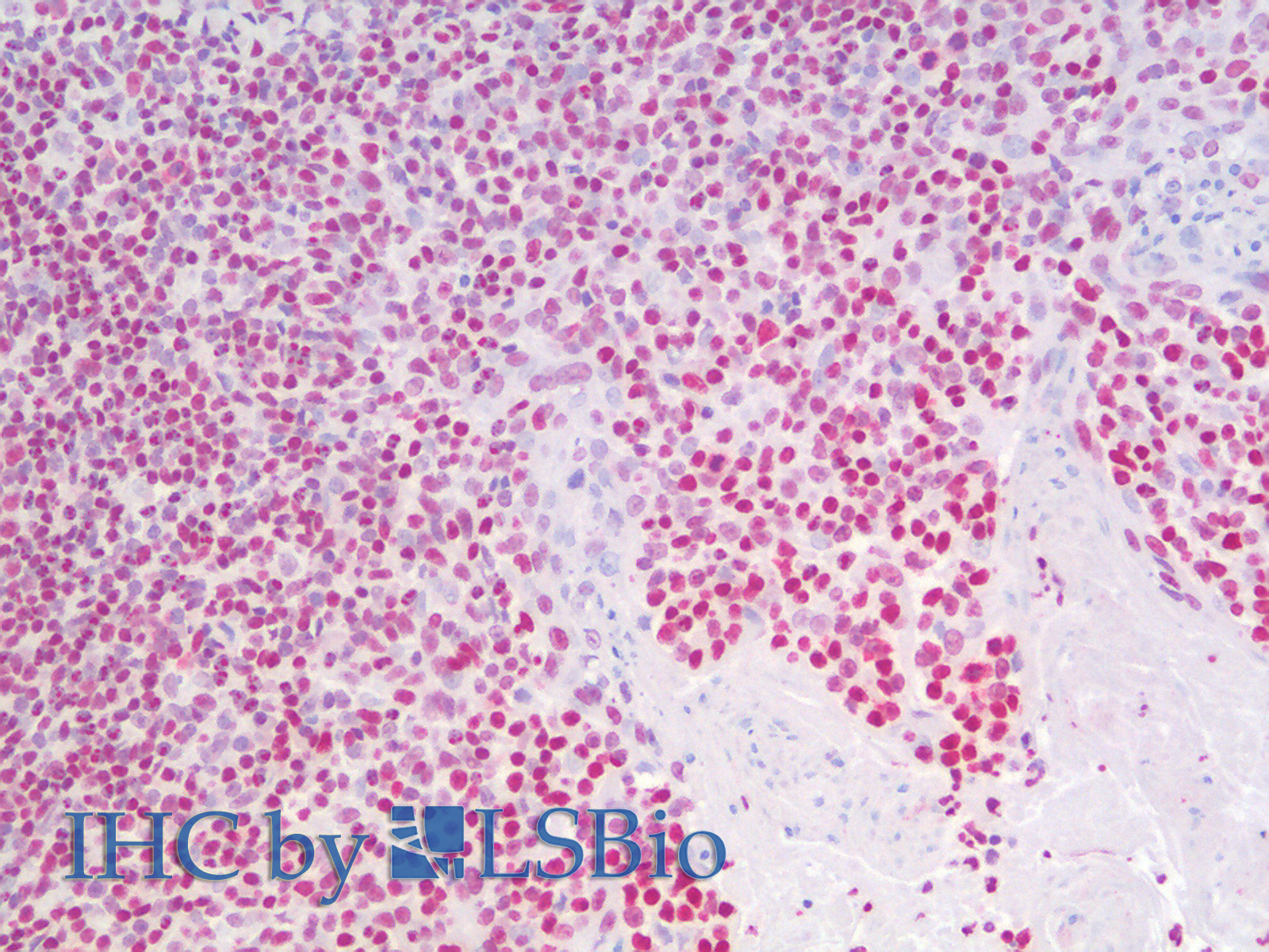 Immunohistochemistry analysis of paraffin-embedded Human Tonsil using HMGB1 Polyclonal Antibody.